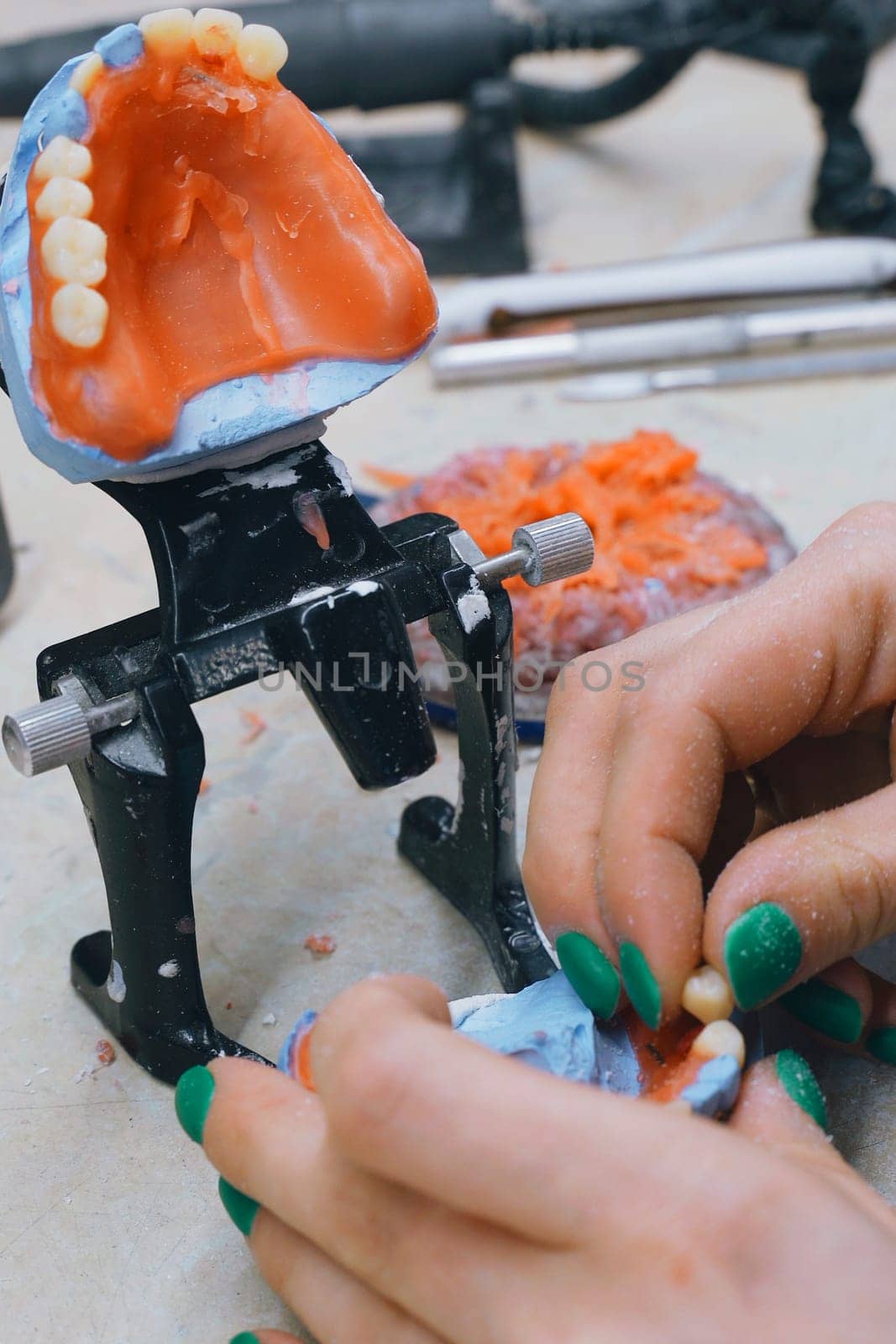 The hands of an orthodontic dental technician make a denture by working with molten liquid wax. Close-up