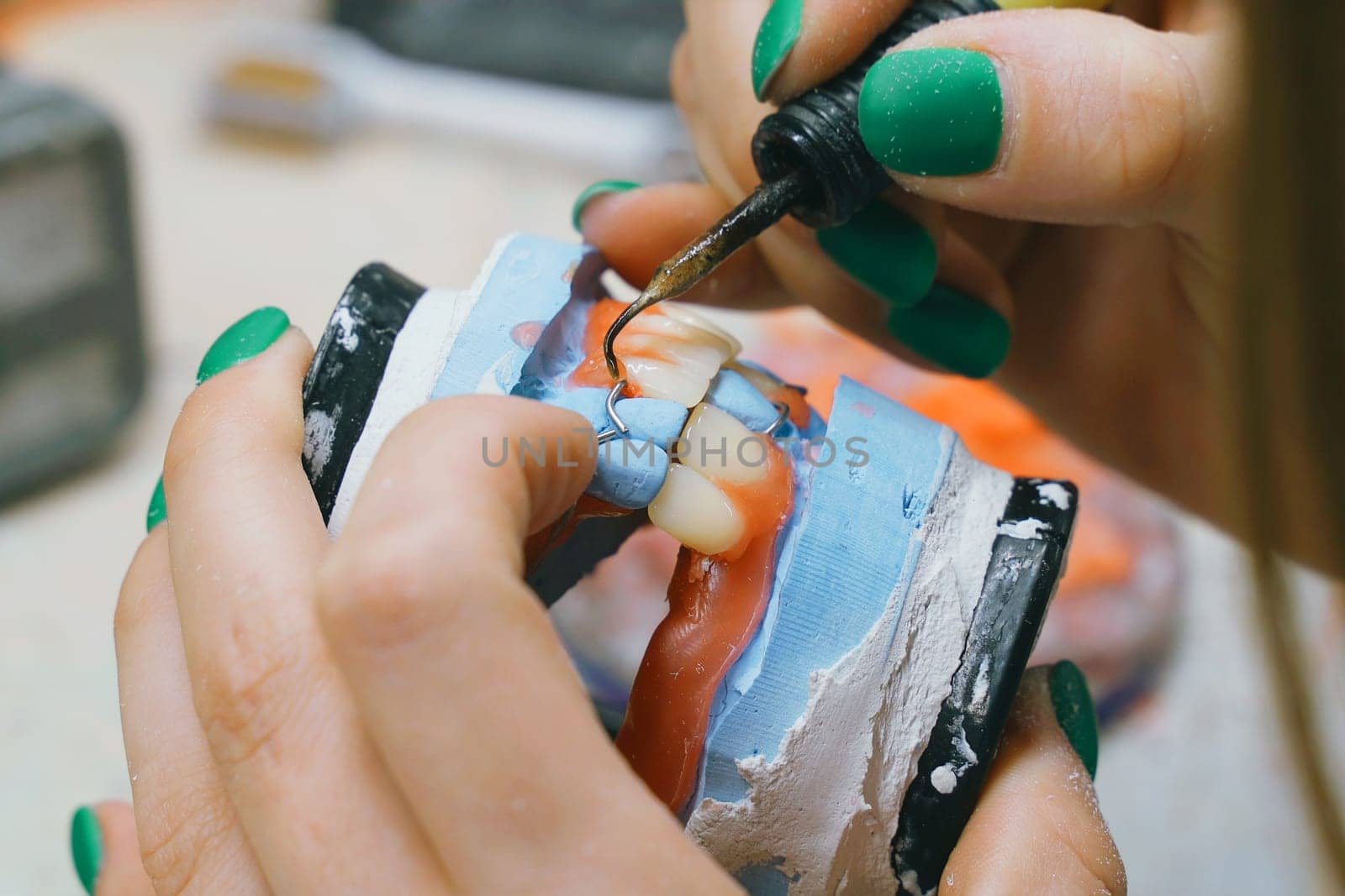 A dental technician works with hot molten wax to make a denture. Close-up.