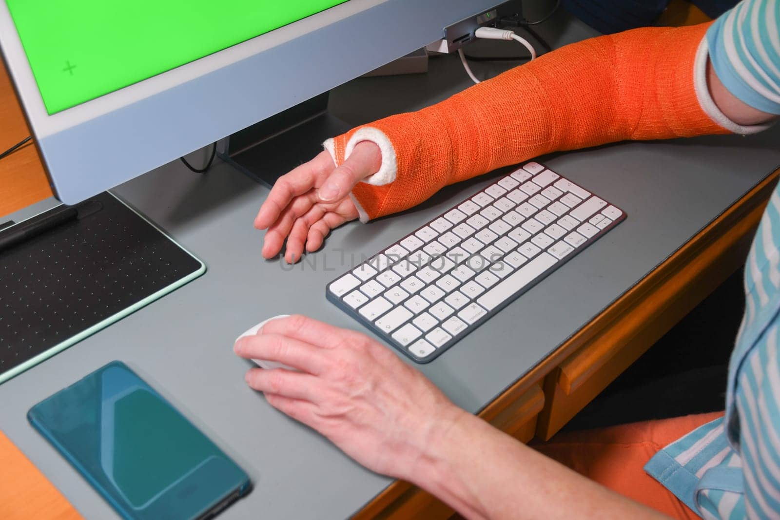 woman with broken right arm in a plastic orange cast works with her left hand on a computer, temporary disability,high quality photo