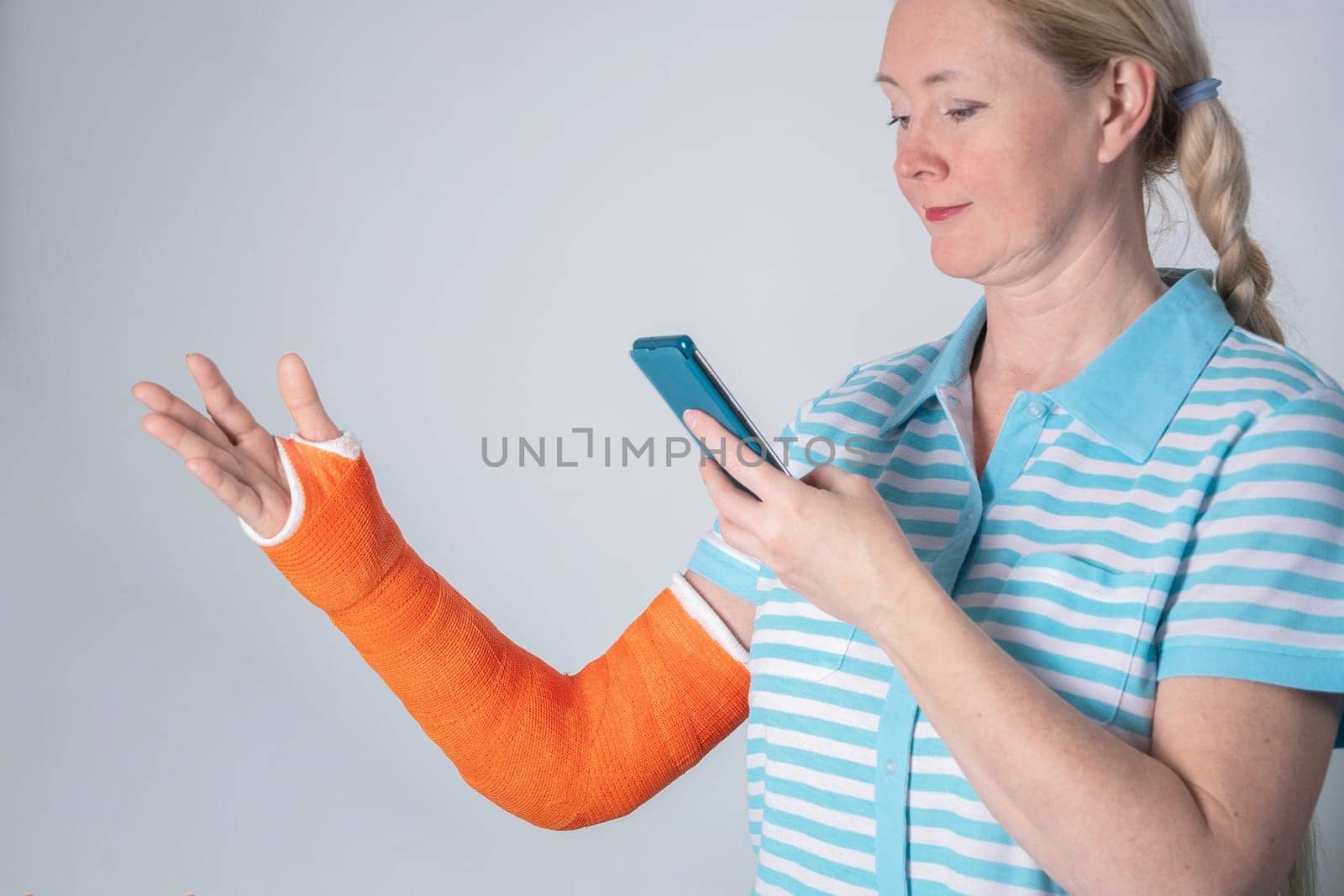 woman with a broken right arm in an orange fiberglass cast watching rehabilitation exercises on a smartphone, on a neutral background,high quality photo