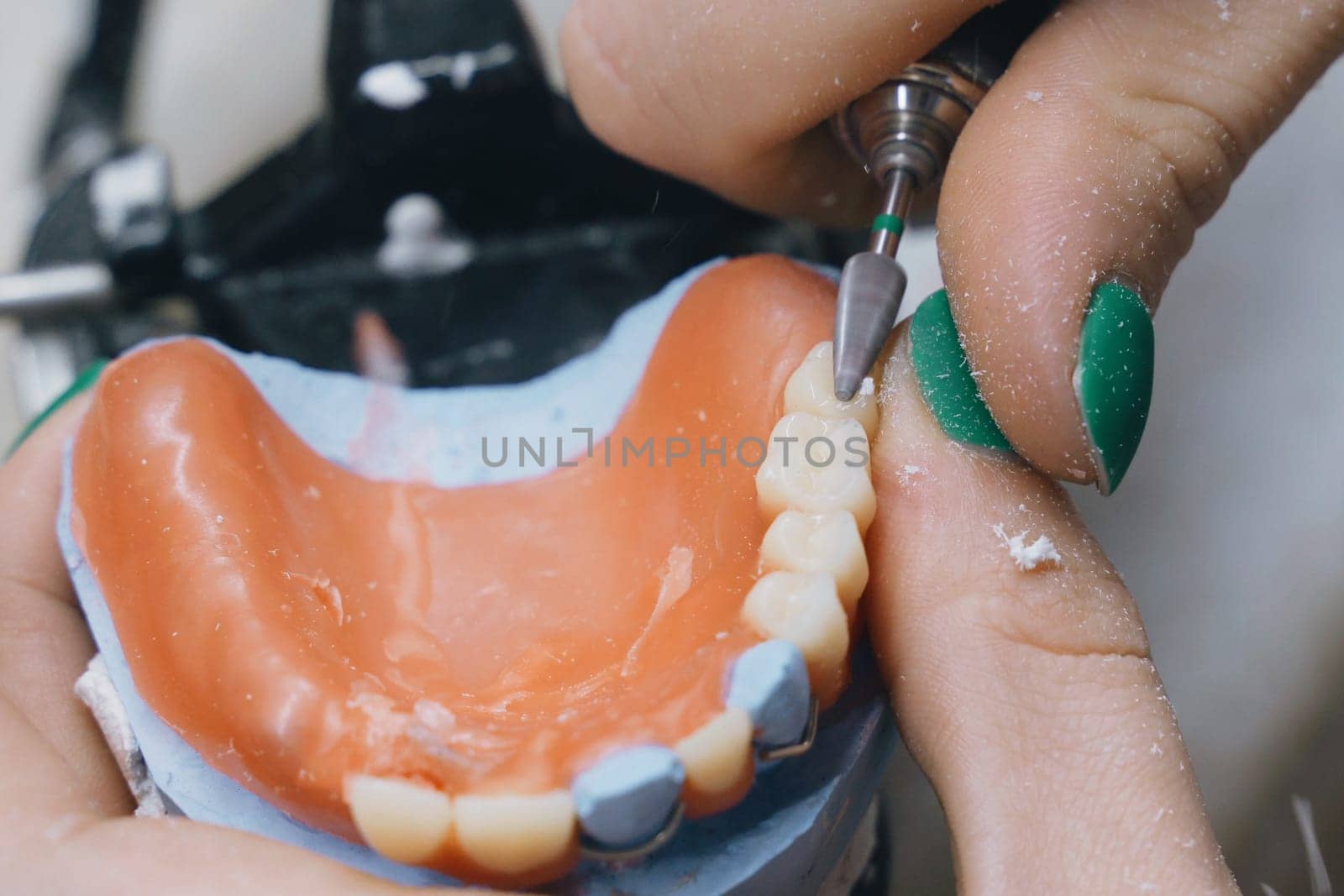 A dental technician cuts and cleans dentures with a milling cutter in a dental laboratory. Close-up