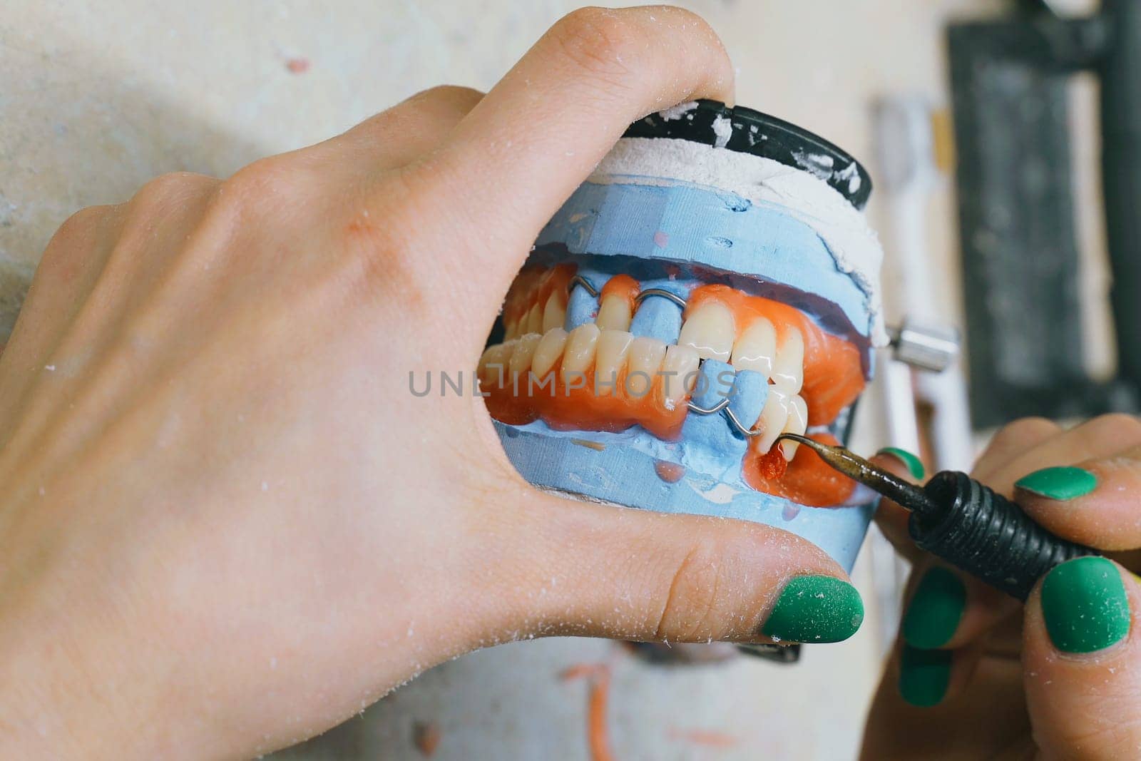 A dental technician works with hot molten wax to make a denture. Close-up.