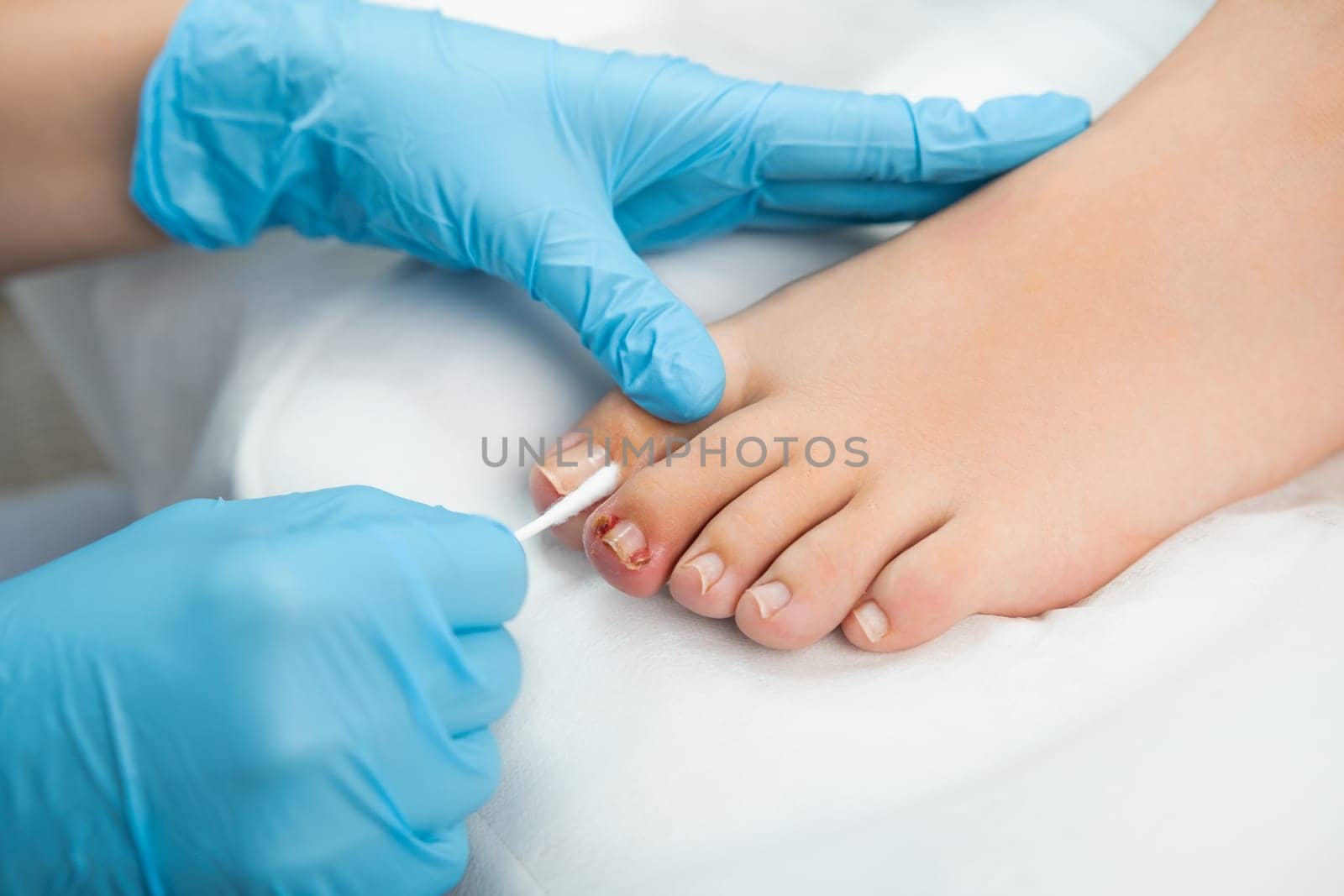 Close up pedicure master treats the nail with an antifungal agent.