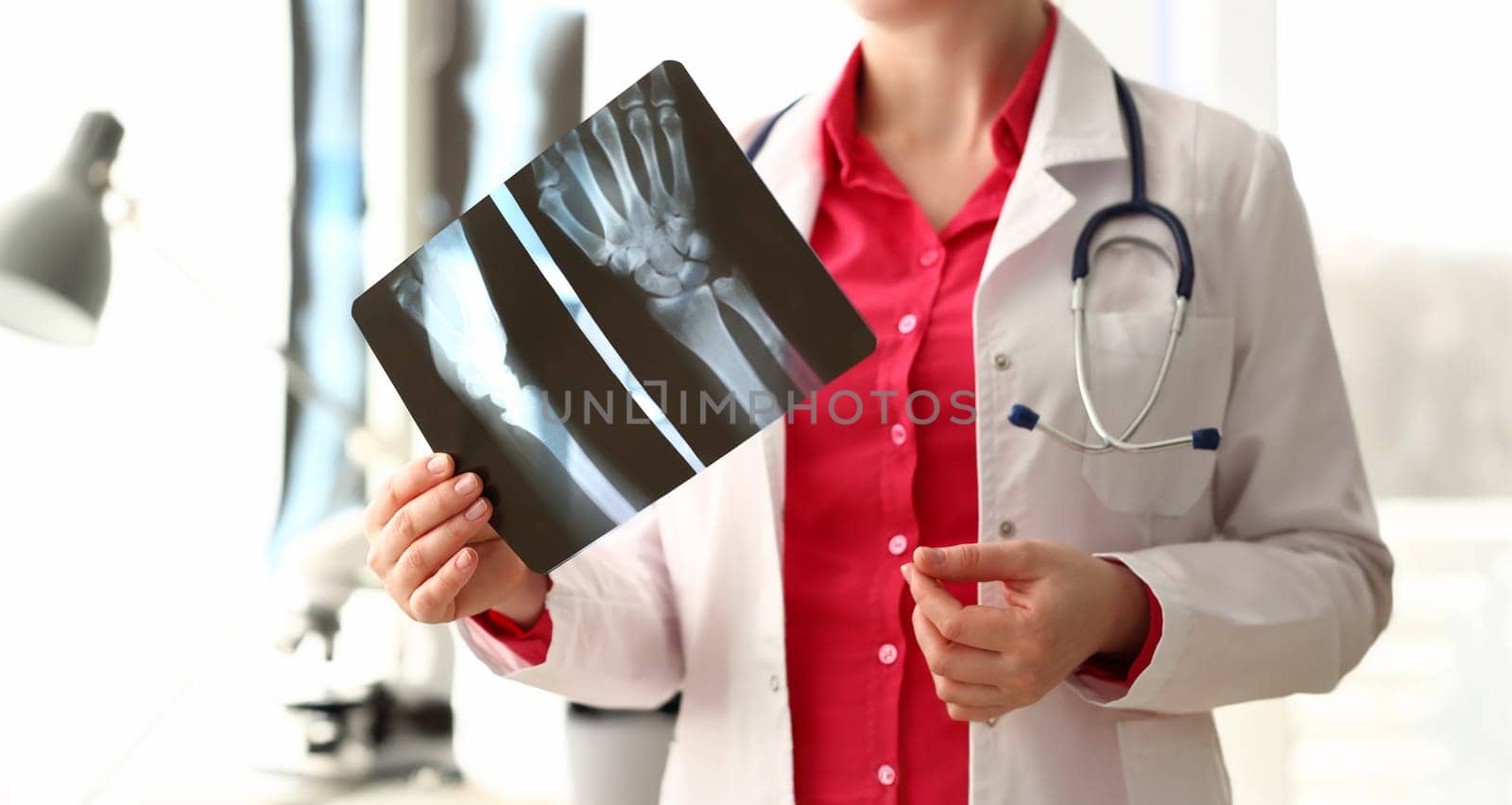 Woman Doctor Holding Right Hand Bone X-ray Image. Female Medic with Stethoscope Examining Photo Scan. Medicine Specialist Analyzing Diagnosis. Doc Physician Standing in White Lab Coat at Hospital