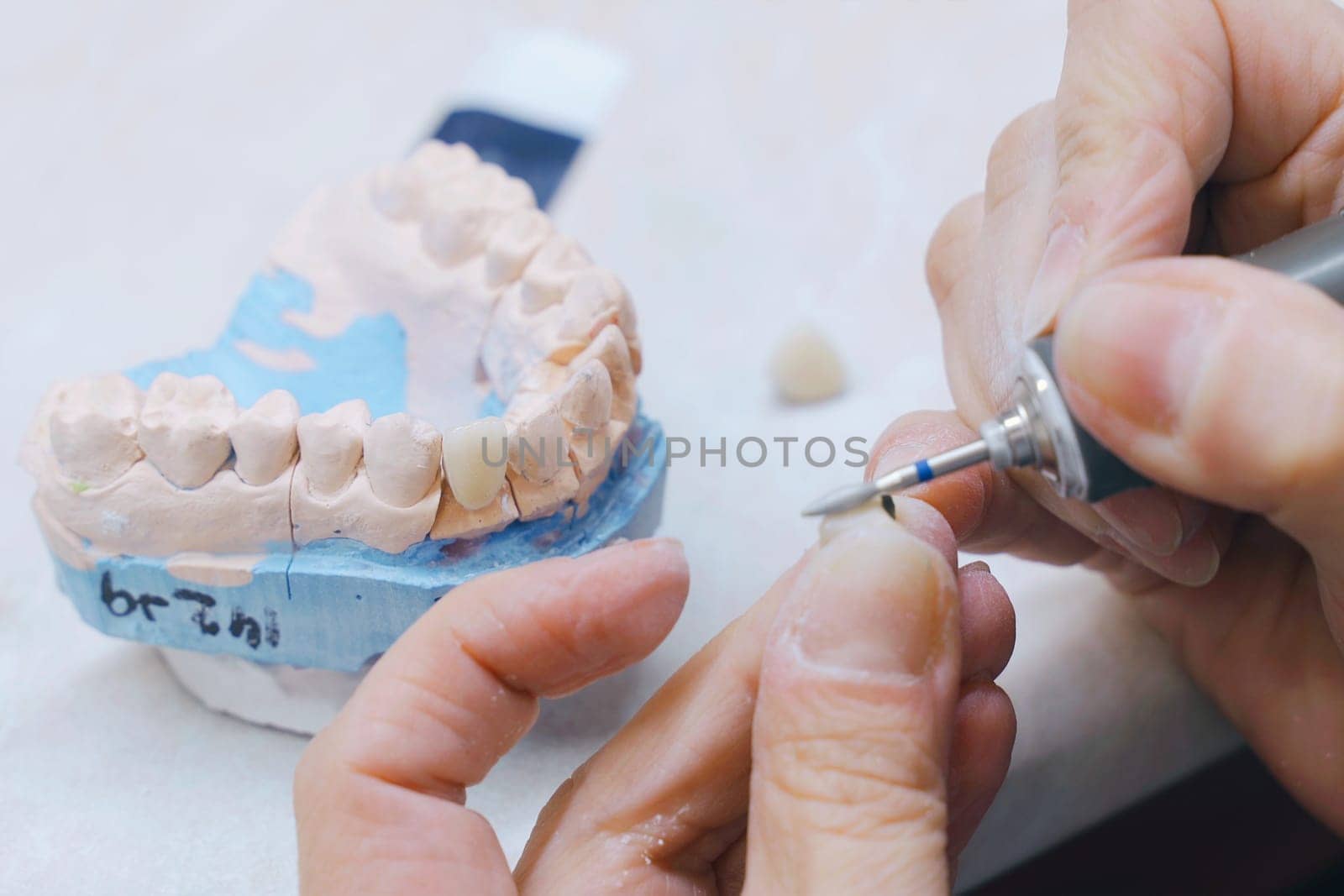 A dental technician cuts and cleans dentures with a milling cutter in a dental laboratory. Close-up