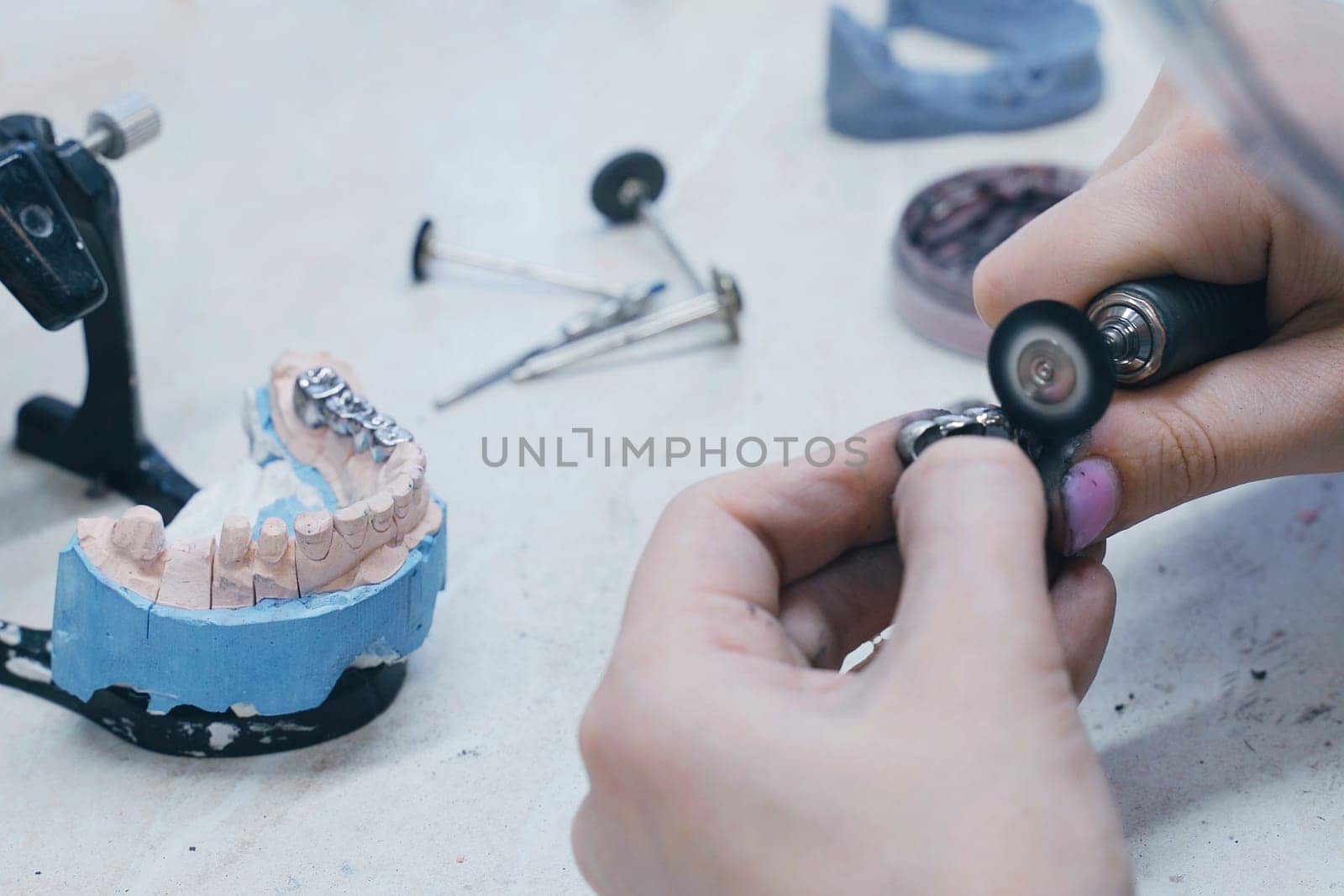 A dental technician works with crowns in a dental laboratory. The dentist manually mills dental crowns.