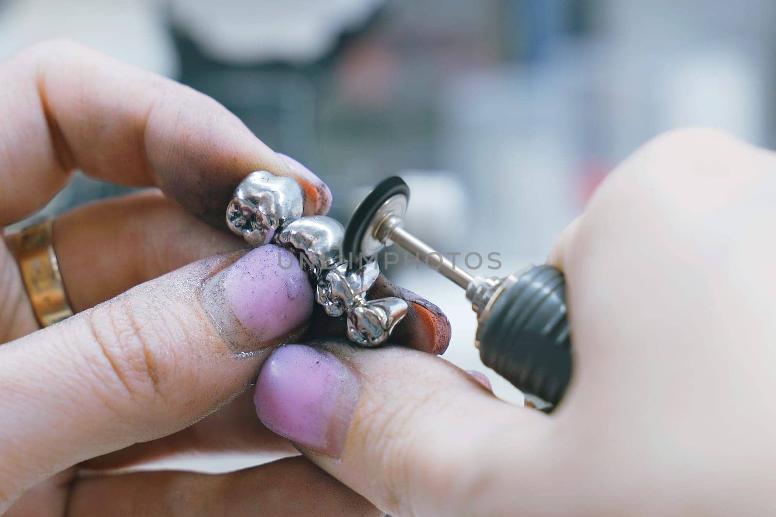 A dental technician is seen working on a toothbrush component in a room, using tools and equipment to manufacture the metal prosthesis.