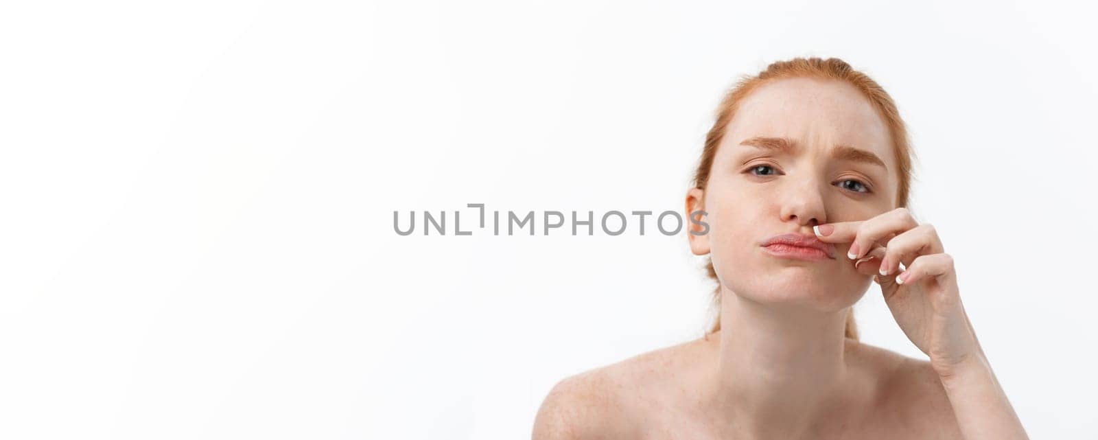 Young caucsian woman squeezes acne on the face of beauty.