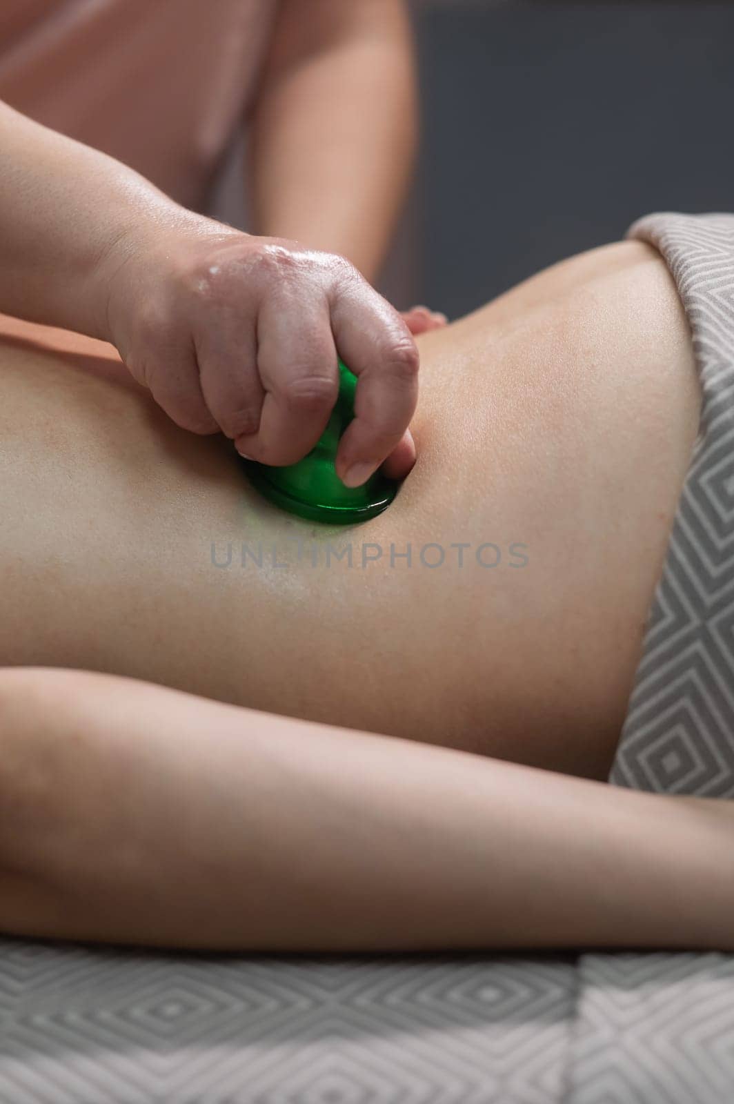 A woman undergoes an anti-cellulite massage procedure using a vacuum jar. Close-up of the lower back. Vertical photo. by mrwed54