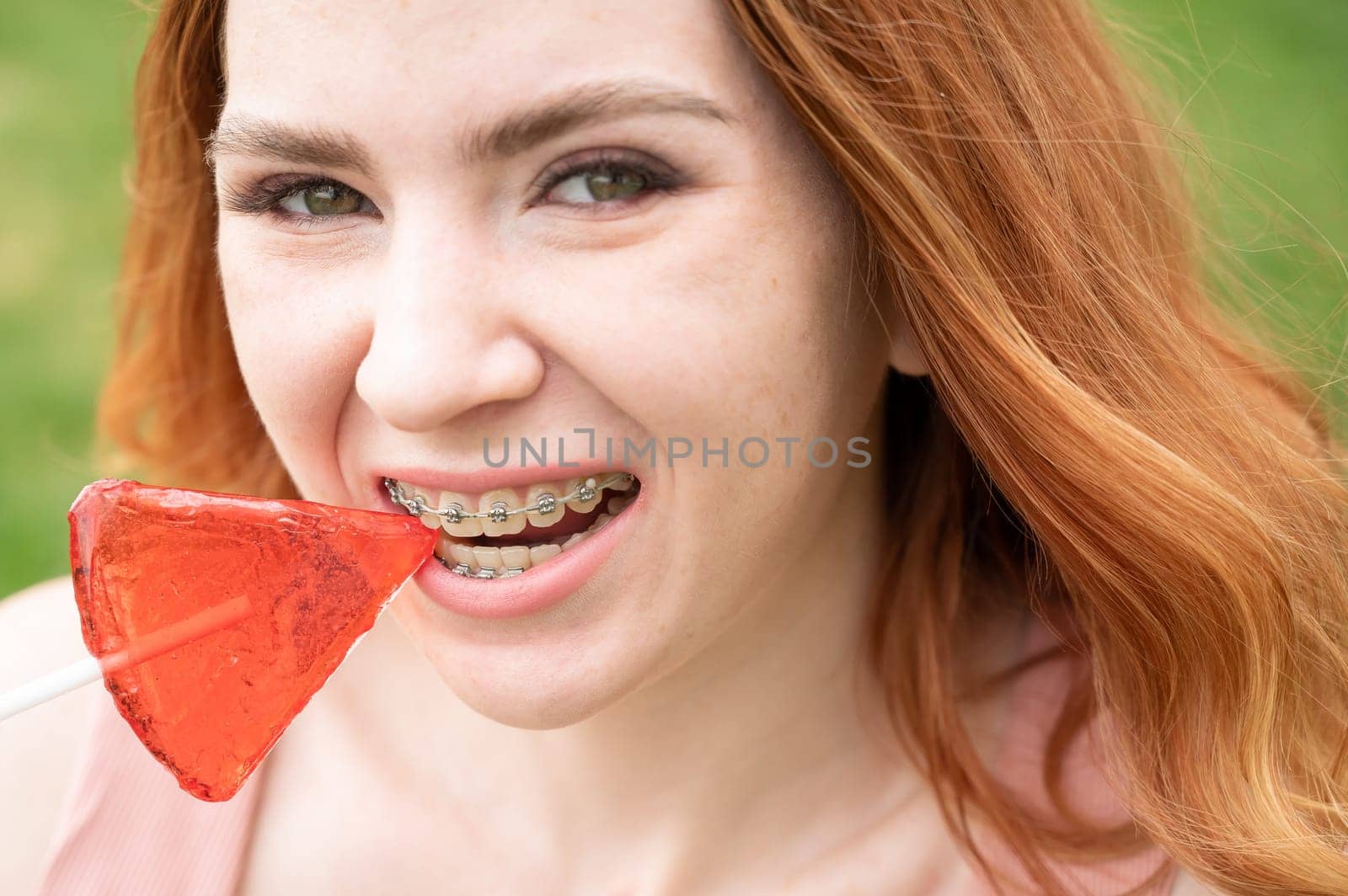 Beautiful young woman with braces on her teeth eats a watermelon-shaped lollipop outdoors. by mrwed54