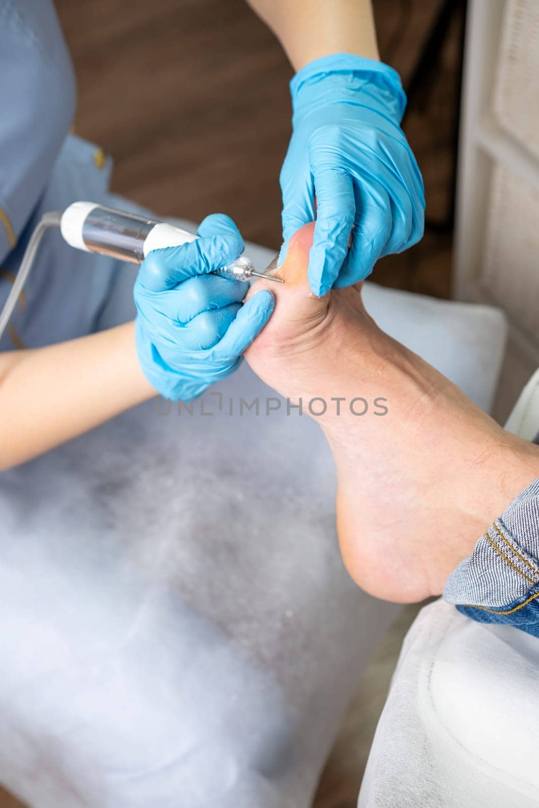 Close up callus removal from a woman's foot is performed by a podiatrist using an electric drill