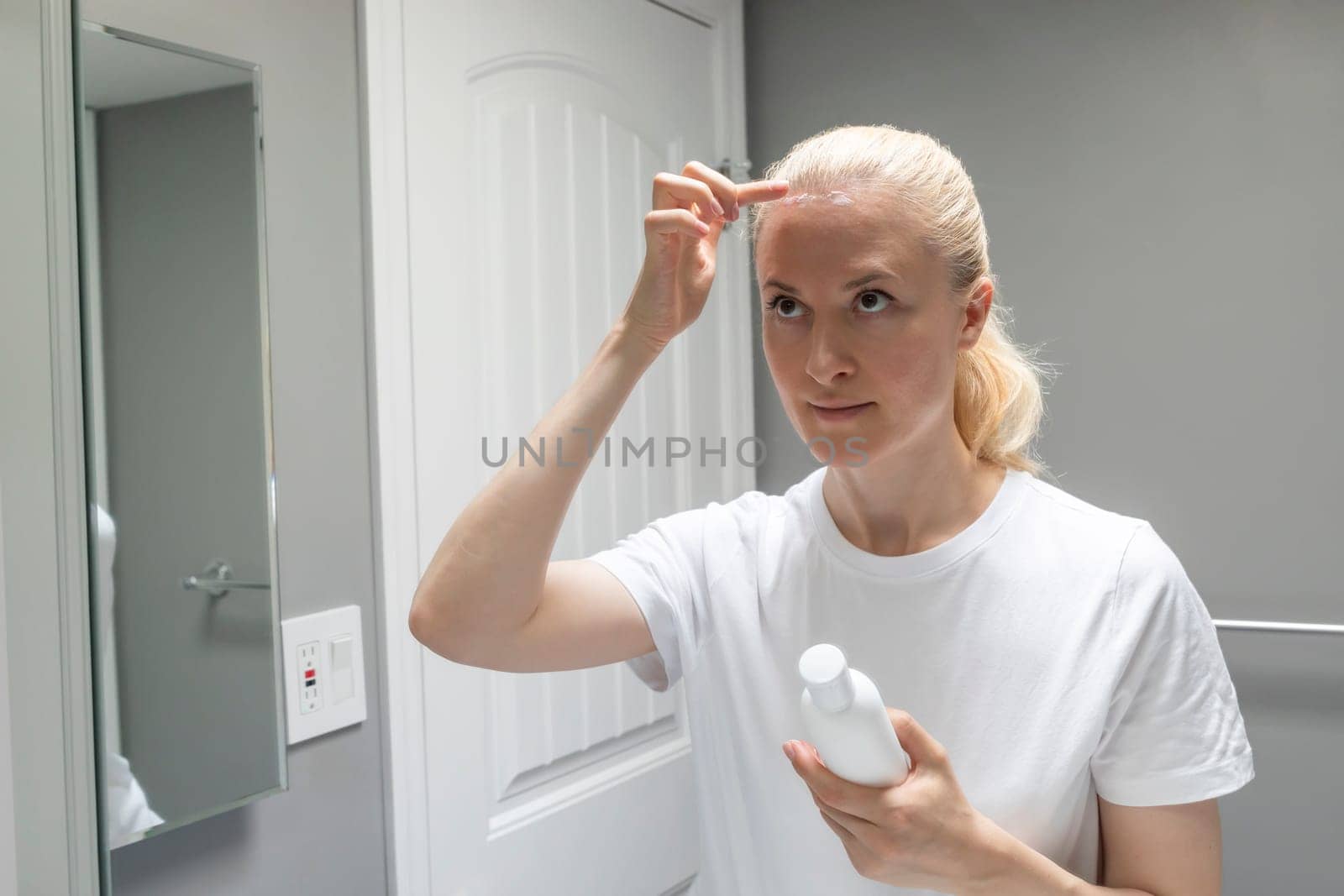 Female Applies Moisturizer, Cream on Sunburn Skin On Scalp, Forehead Under Hair in Bathroom. White Woman Suffers From Sun Burn, Holding White Tube, Bottle of Remedy. Horizontal. UV Danger.