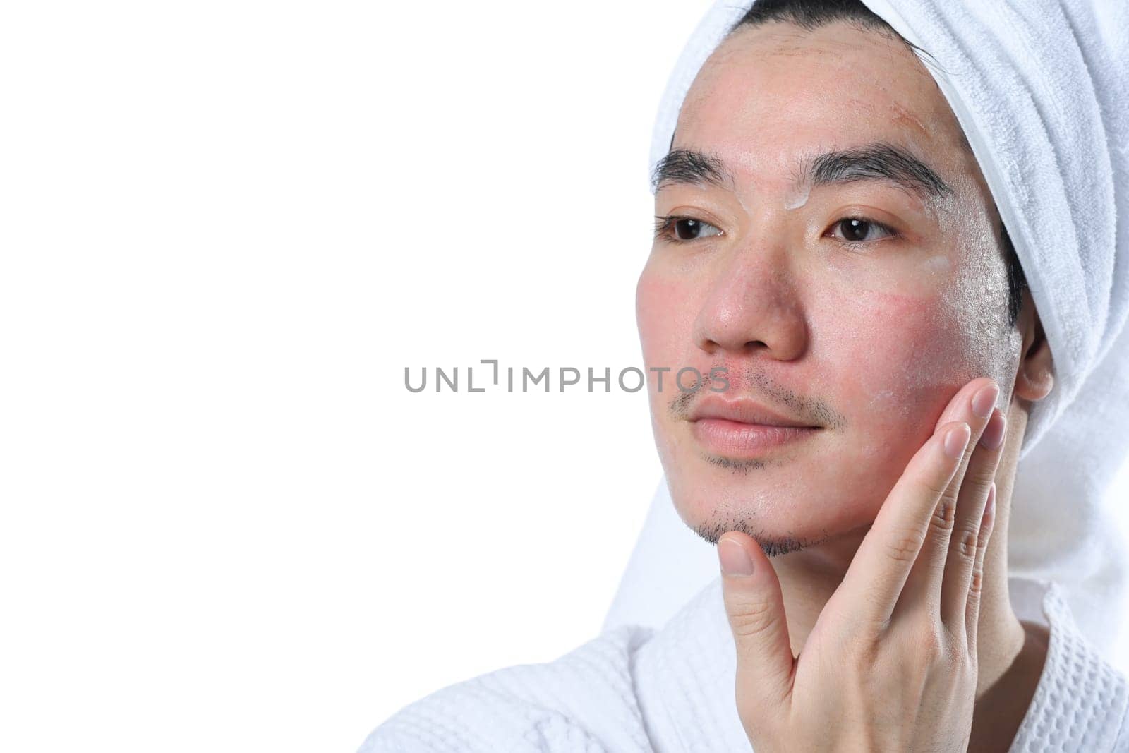 Young man in bathrobe applying moisturizer on his face carefully for rapid recovery after laser skin resurfacing.