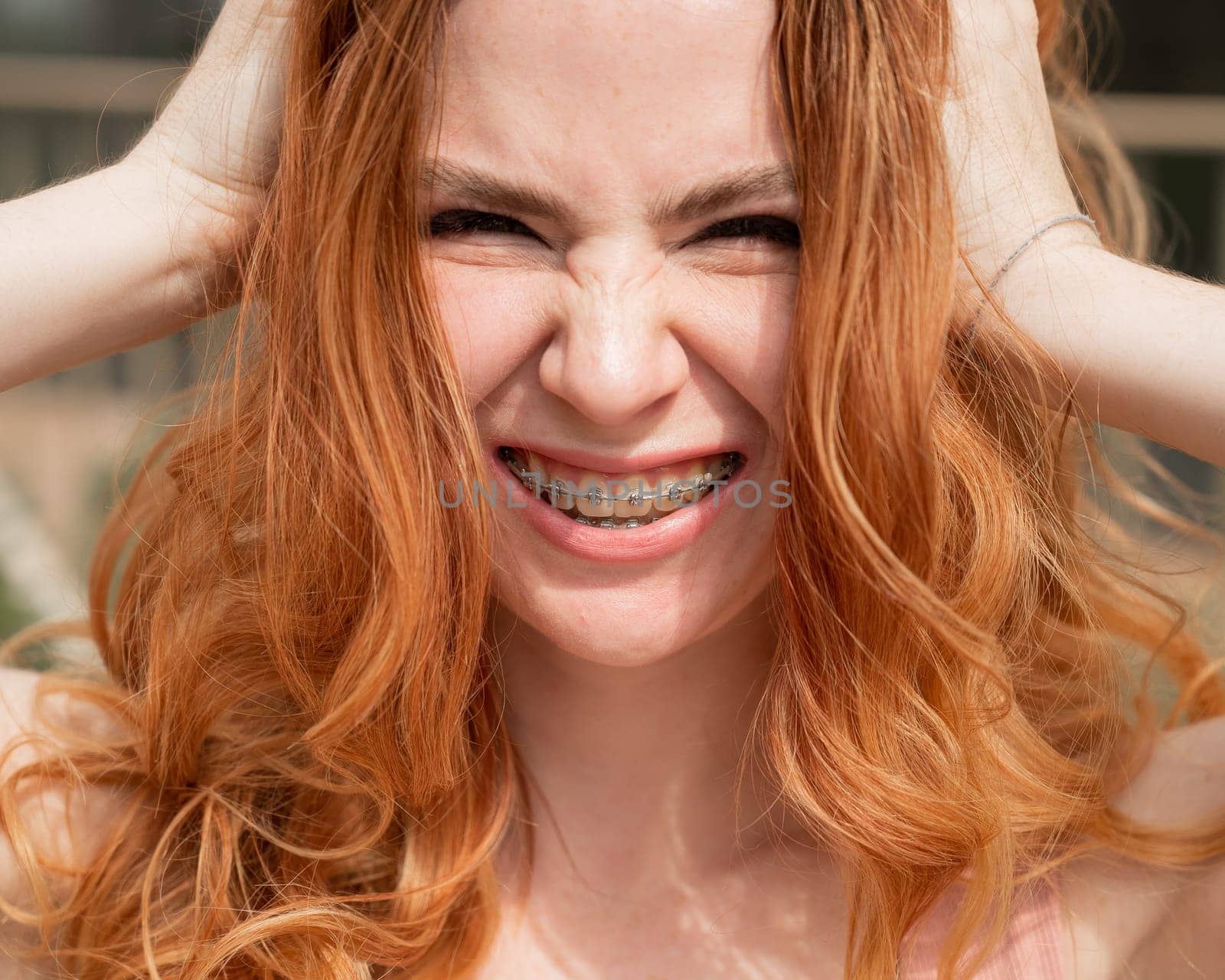 Close-up portrait of a young red-haired woman with braces on her teeth. Girl makes faces at the camera outdoors. by mrwed54