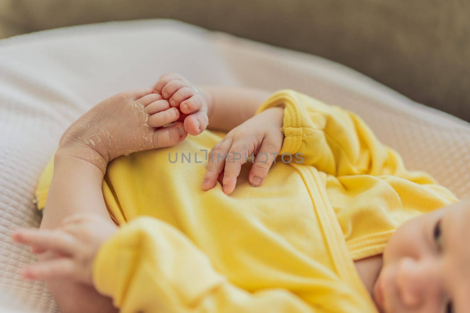 The newborn's skin is peeling. Mom uses skin products and massages to care for and soothe the baby's delicate skin, ensuring comfort and promoting healthy skin.