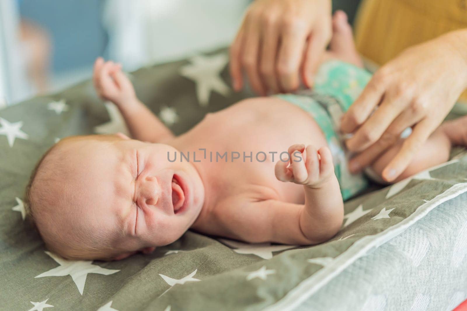 The newborn's skin is peeling. Mom uses skin products and massages to care for and soothe the baby's delicate skin, ensuring comfort and promoting healthy skin.