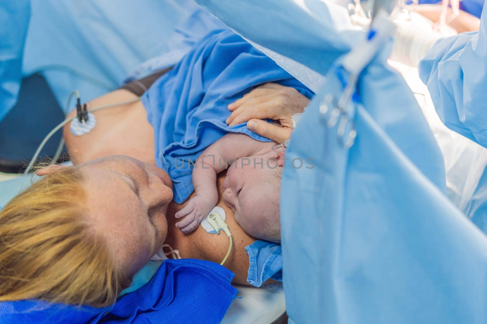 Baby on mother's chest immediately after birth in a hospital. The mother and newborn share a tender moment, emphasizing the bond and emotional connection. The medical staff ensures a safe and caring environment by galitskaya