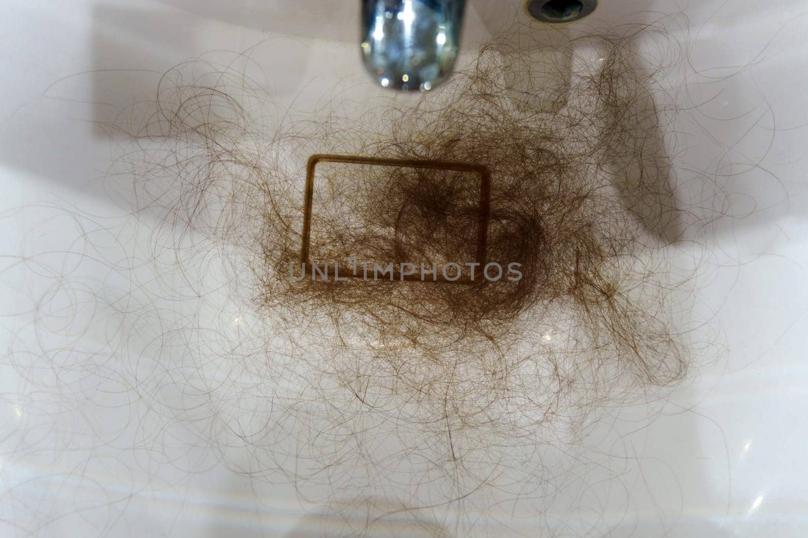 Struggles of Hair Loss. A Personal Journey confronting hair loss. Selective focus