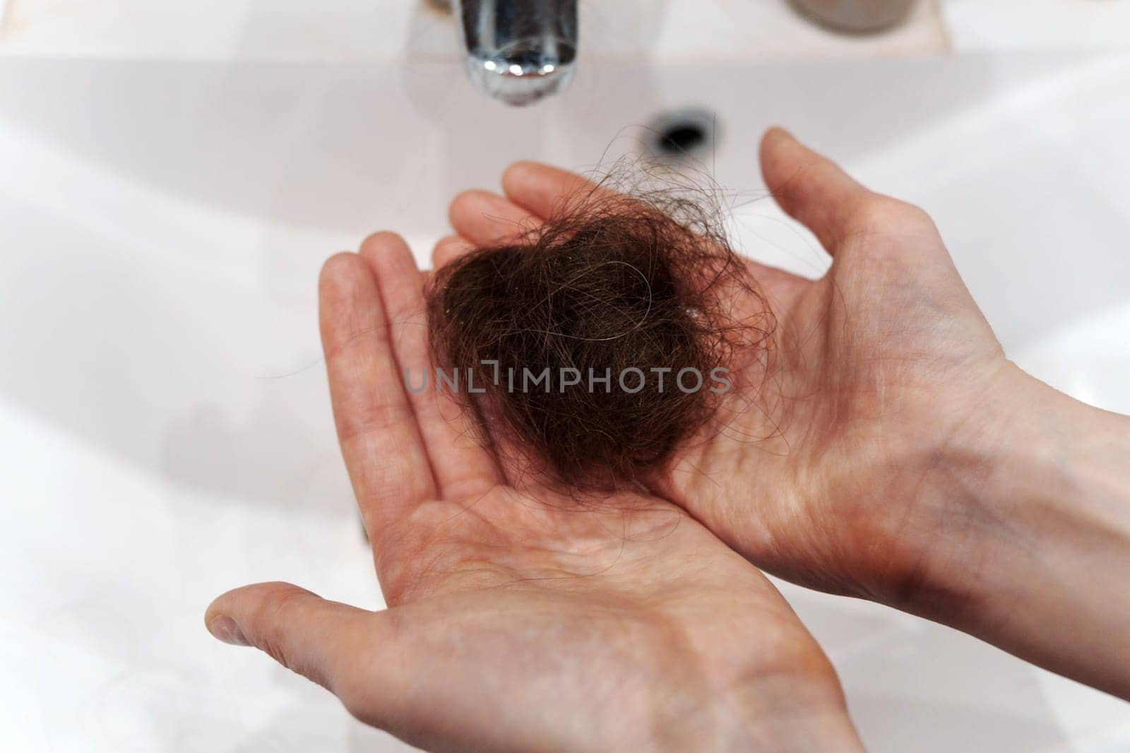 Struggles of Hair Loss. A Personal Journey confronting hair loss. Selective focus