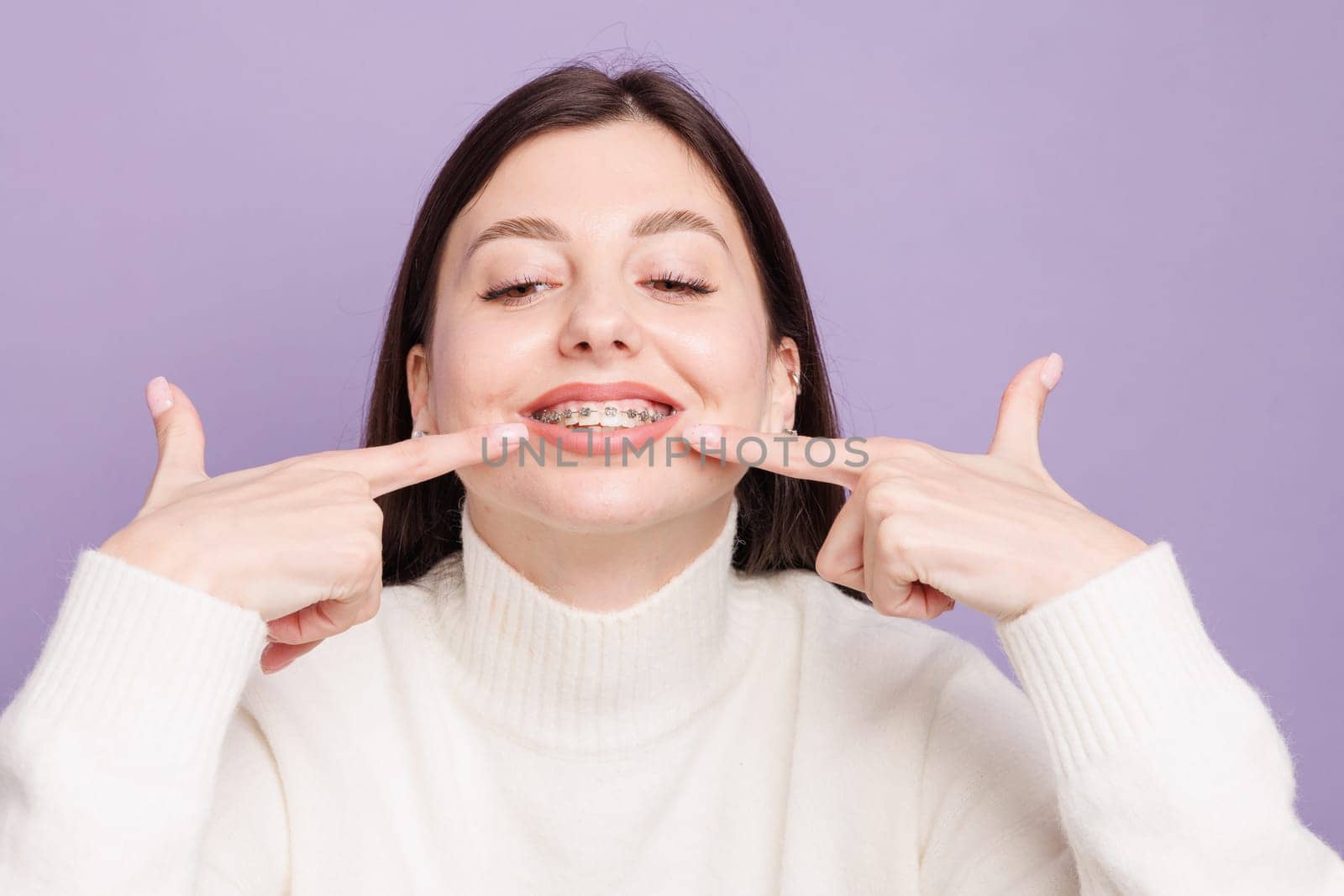 portrait of a girl with braces close-up, woman is happy with braces, beautiful teeth concept