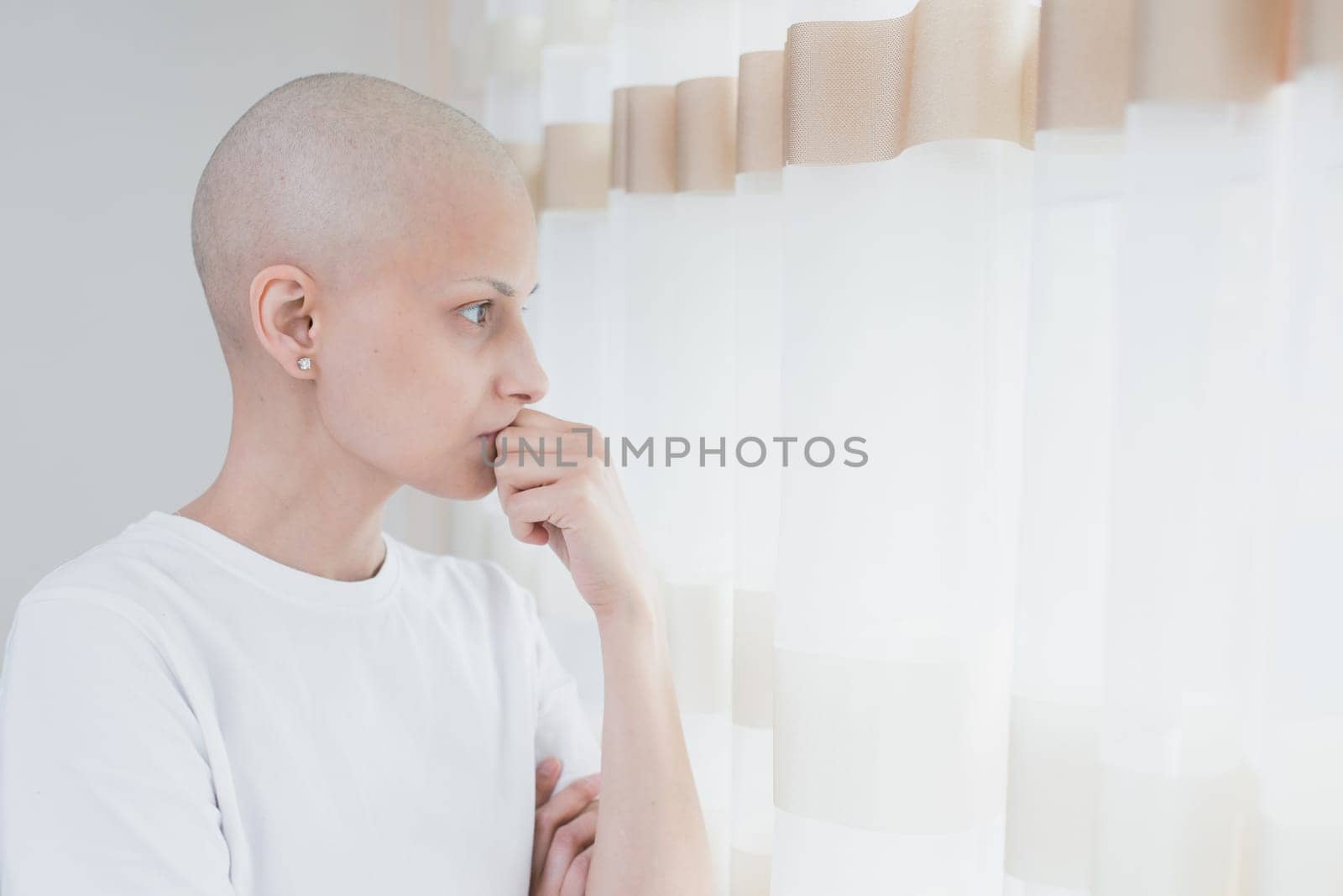 Bald woman with cancer wearing a white t-shirt looking at window.