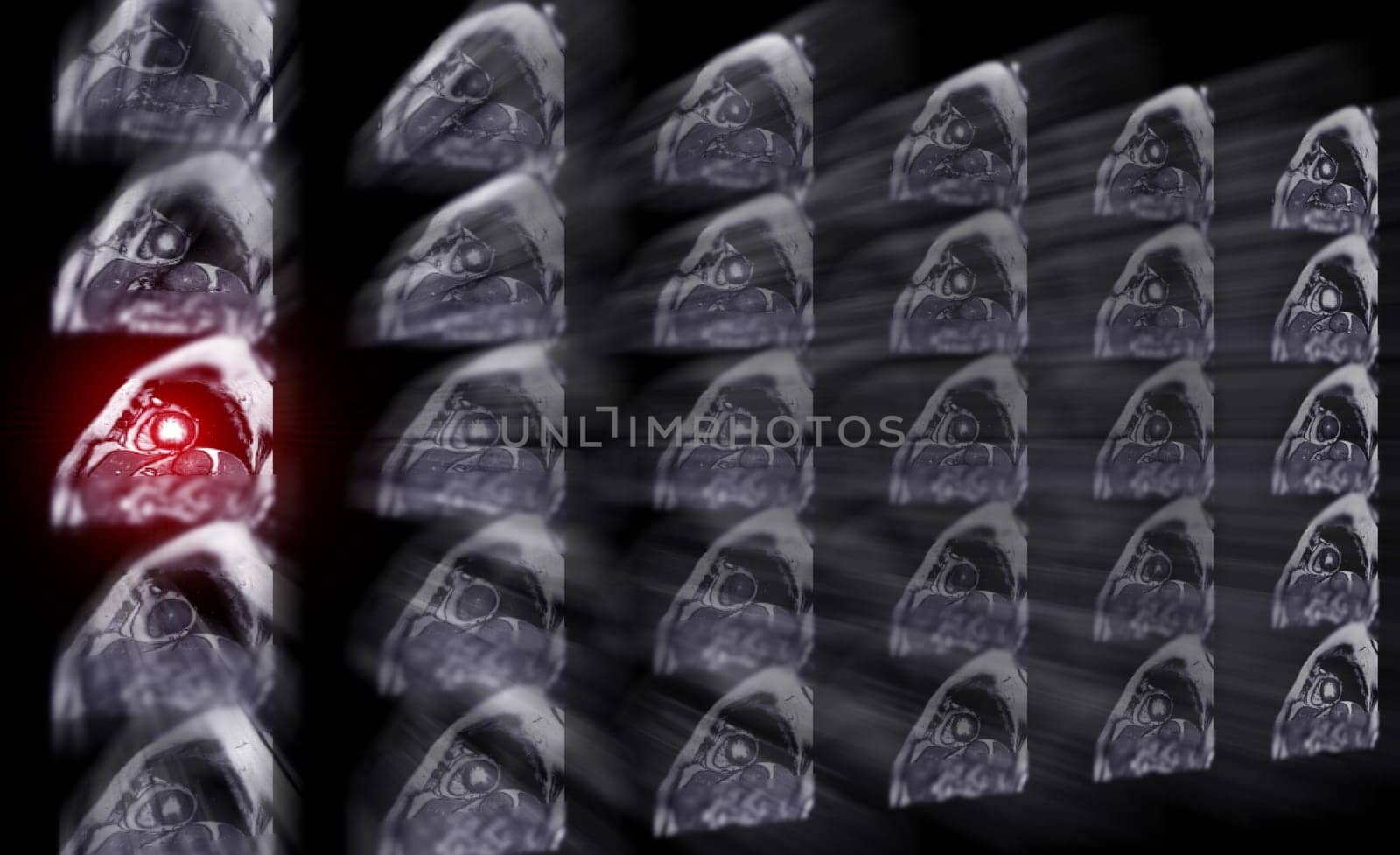 MRI heart or Cardiac MRI ( magnetic resonance imaging ) of heart for diagnosis heart disease.