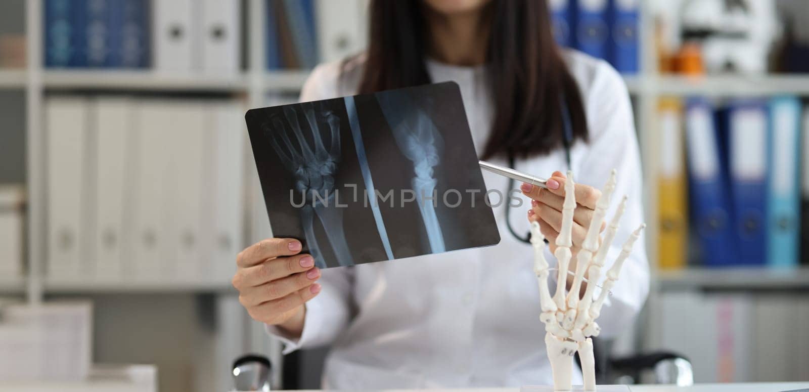 Close-up of traumatologist in uniform examine patient scan, prepare conclusion. Medical worker analyzing patient hand xray result. Healthcare and injury concept