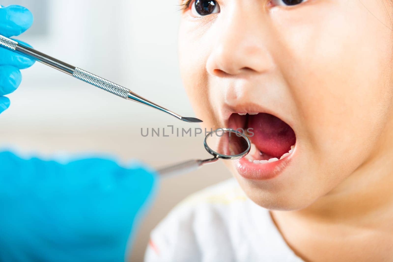 Doctor examines oral cavity of little child uses mouth mirror to checking teeth cavity by Sorapop