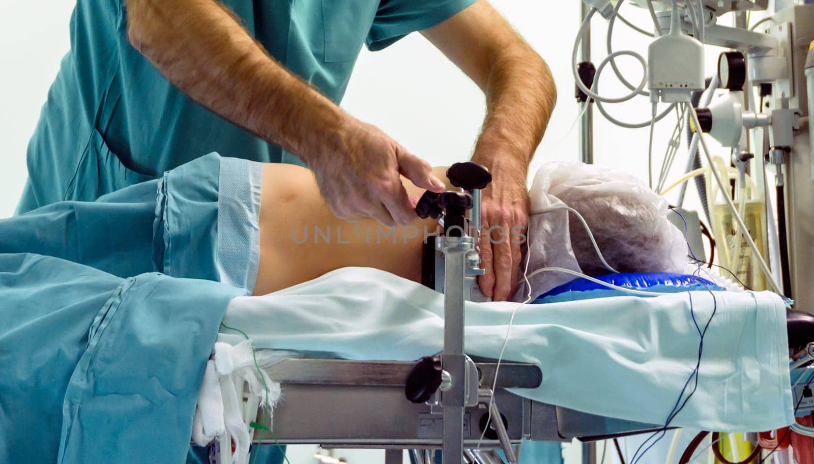 medicinemedicine, spinal surgery to remove the vertebra, spinal surgery to remove the vertebra