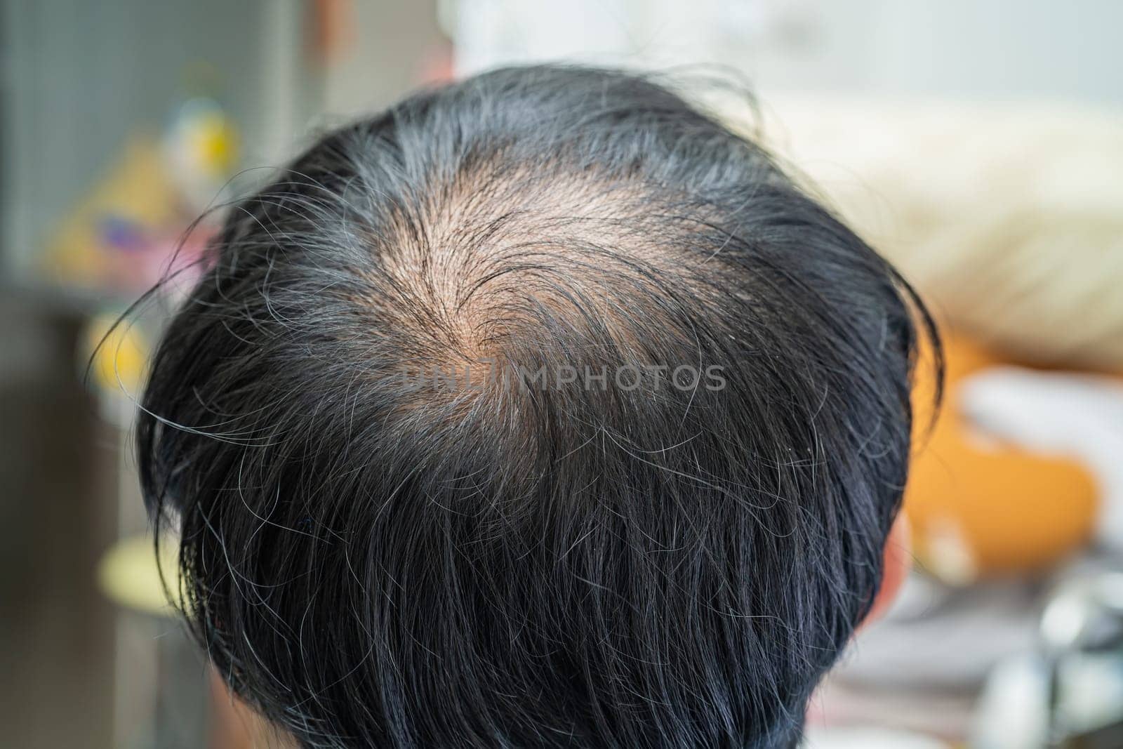 Bald in the middle head and begin no loss hair glabrous of mature Asian business smart active office man.