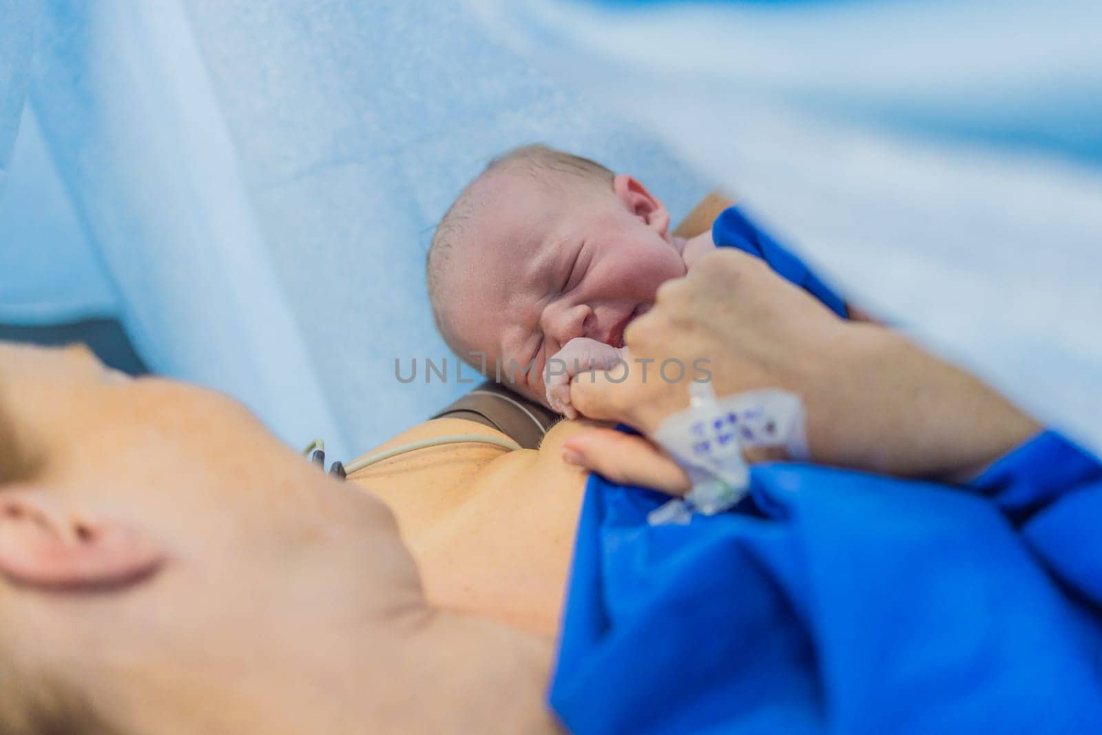 Baby on mother's chest immediately after birth in a hospital. The mother and newborn share a tender moment, emphasizing the bond and emotional connection. The medical staff ensures a safe and caring environment.