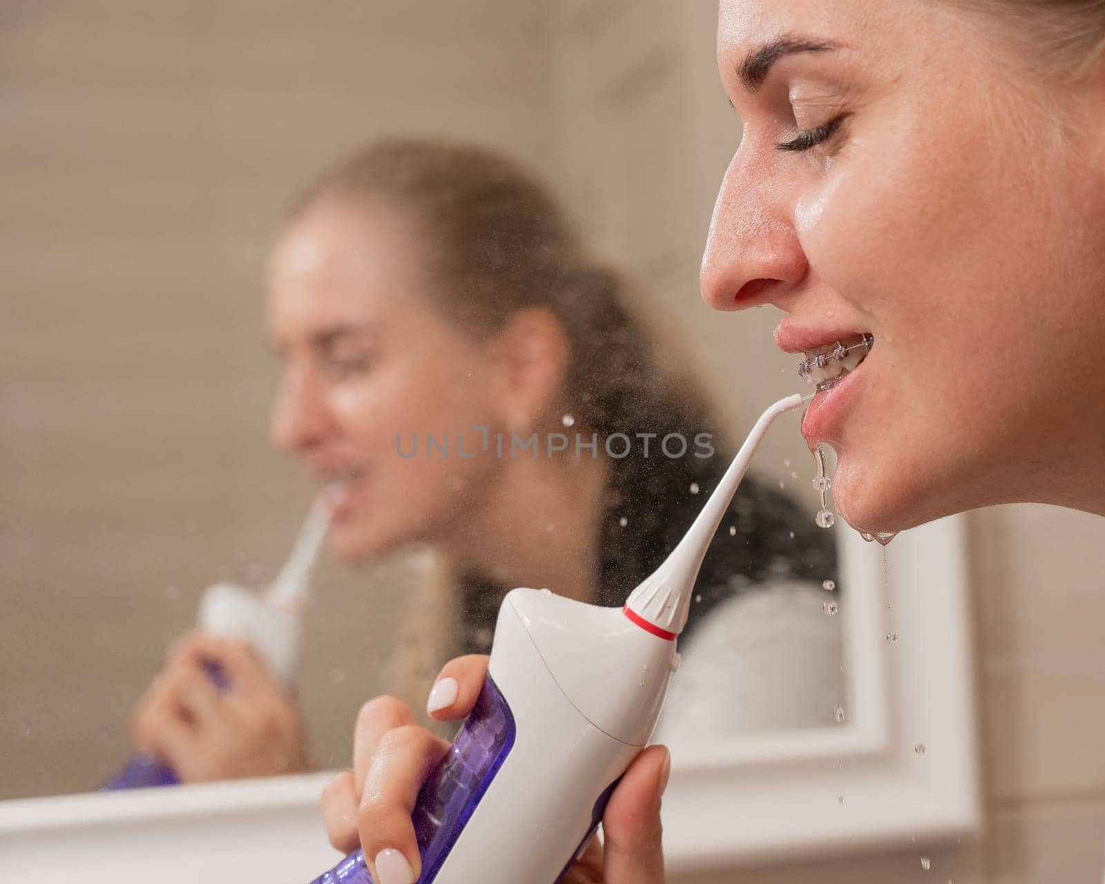 A woman with braces on her teeth uses an irrigator. Close-up portrait