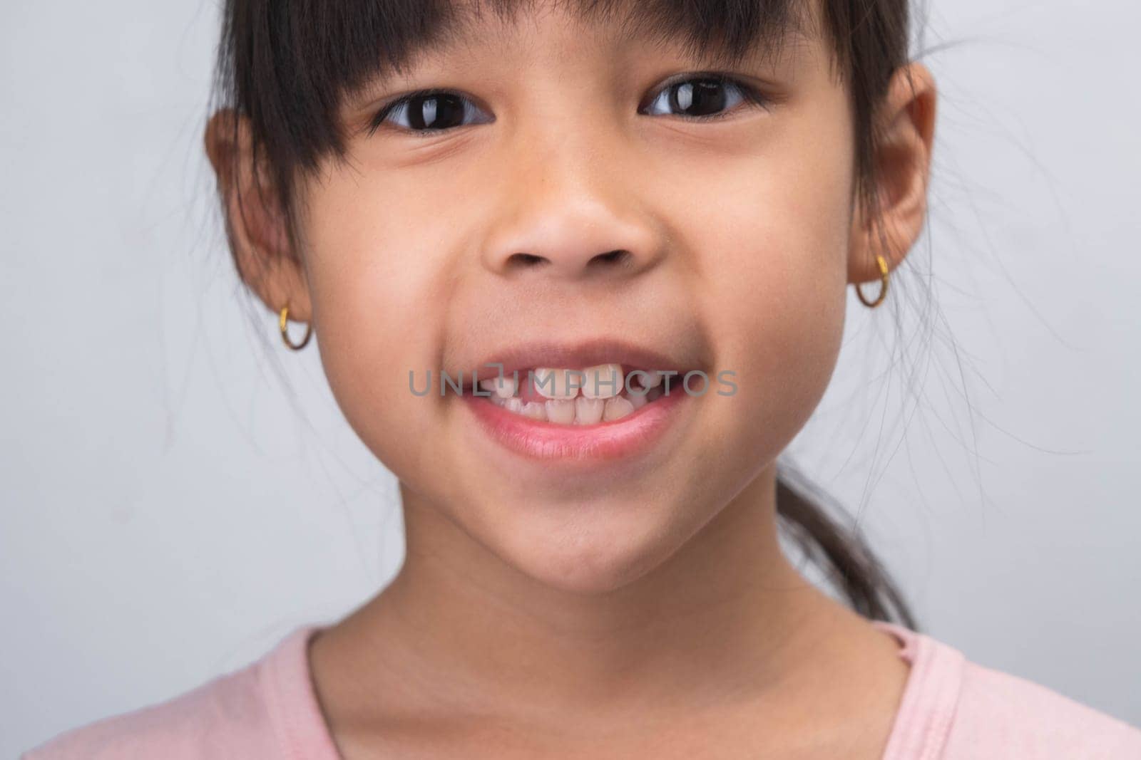 Close-up of cute young girl smiling wide, showing empty space with growing first front teeth. Little girl with big smile and missing milk teeth. Dental hygiene concept