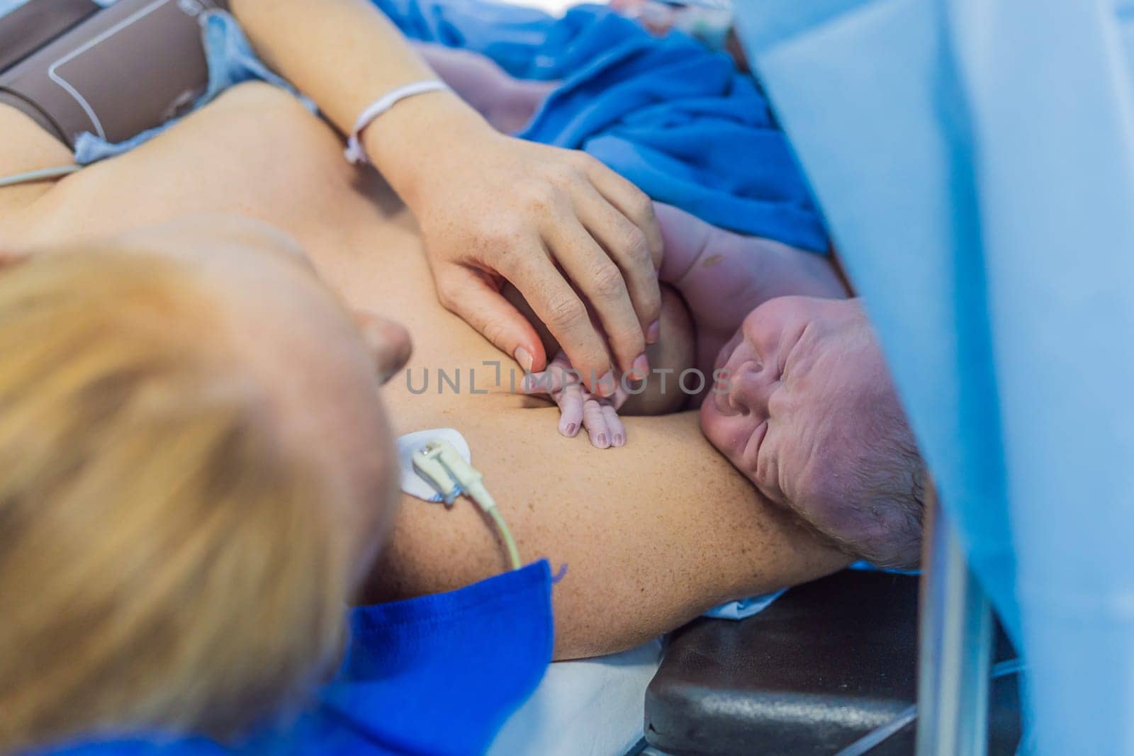 Baby on mother's chest immediately after birth in a hospital. The mother and newborn share a tender moment, emphasizing the bond and emotional connection. The medical staff ensures a safe and caring environment.