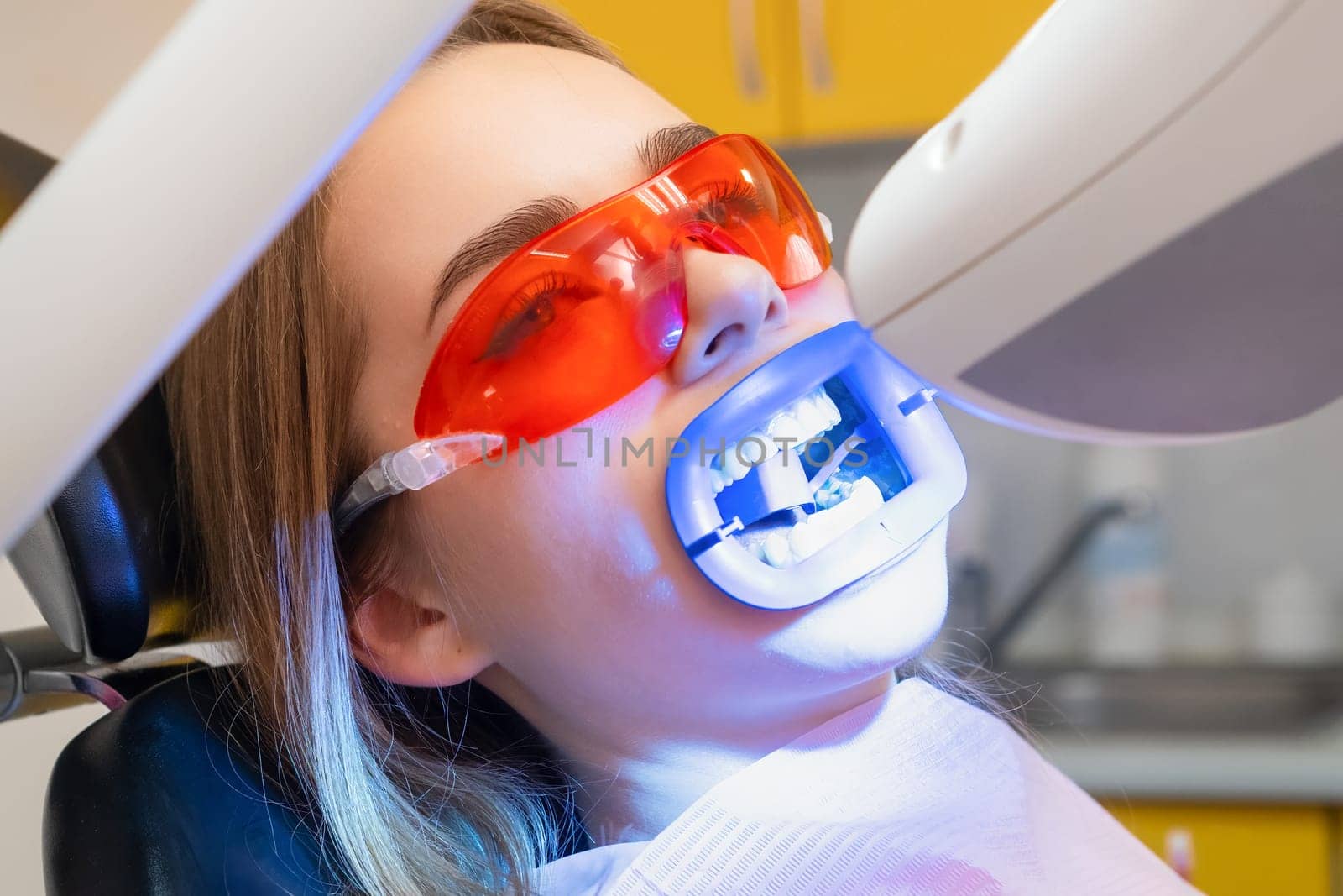 UV lamp shines on the patiens teeth during teeth whitening at dentist clinic by vladimka