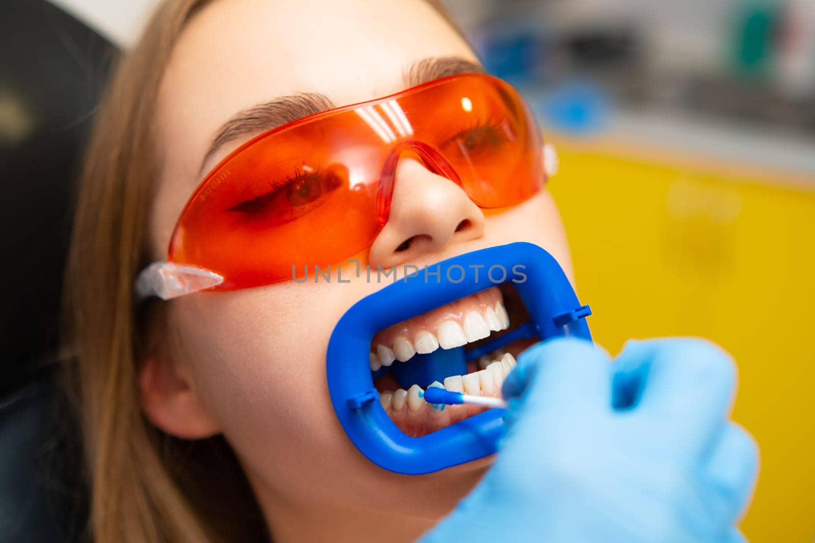 Dentist applies whitening gel to patient teeth in the dental clinic. by vladimka