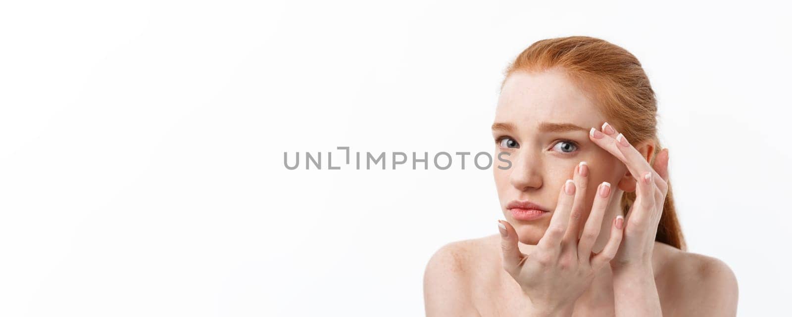 Young caucsian woman squeezes acne on the face of beauty.