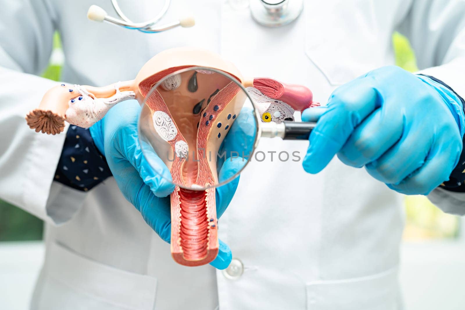 Uterus, doctor holding anatomy model for study diagnosis and treatment in hospital. by pamai