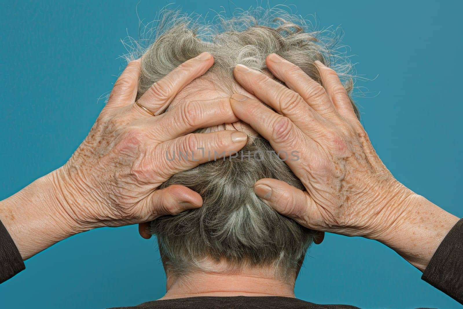 Senior woman covering bold spots on her head with hands