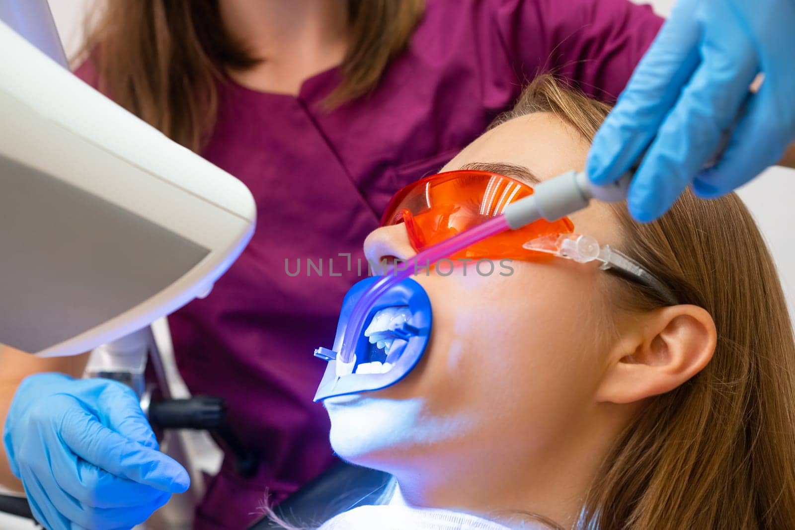 Close up dentist uses saliva ejector while doing a professional whitening of teeth for young patient