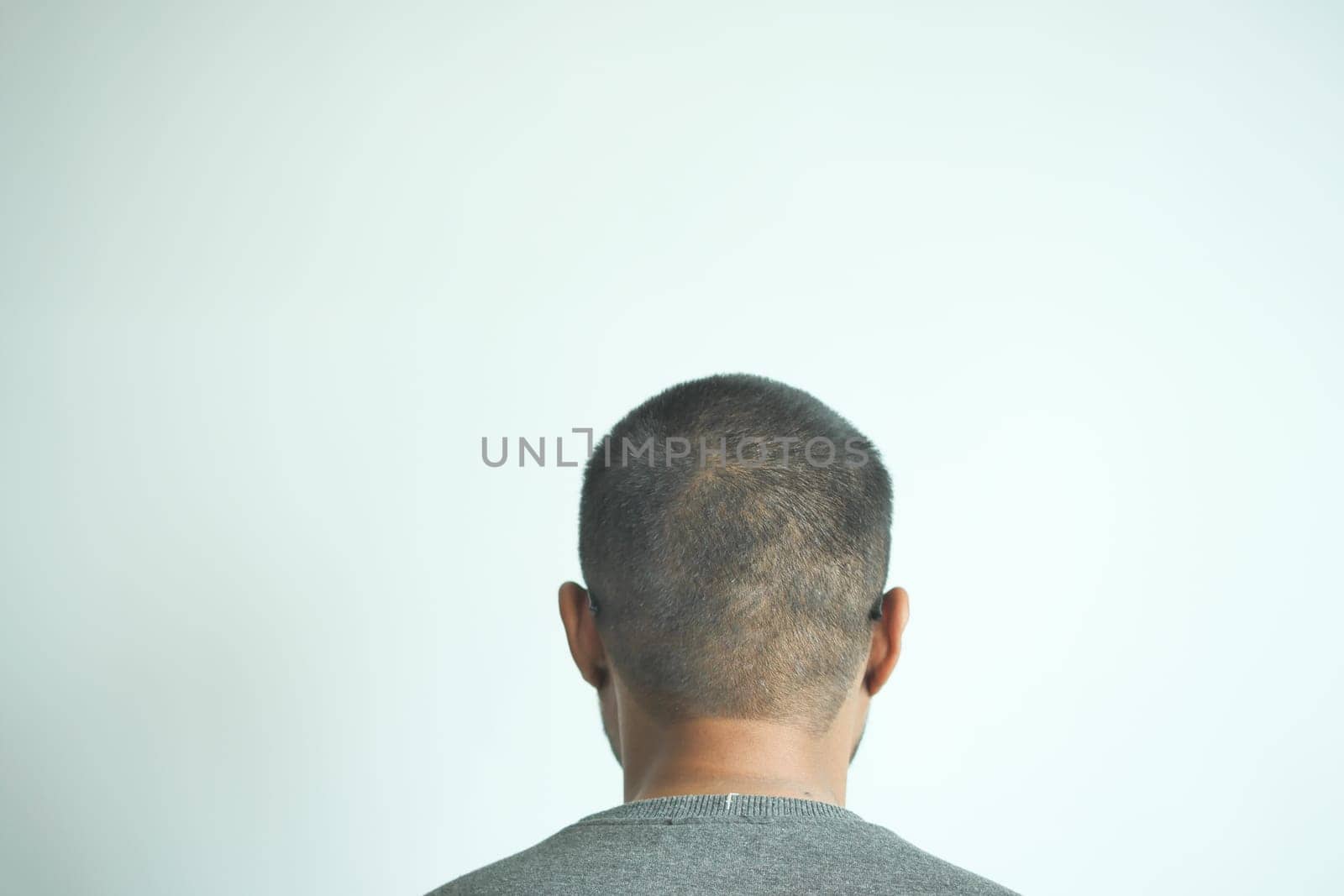 hair loss concept with man checking his hair .