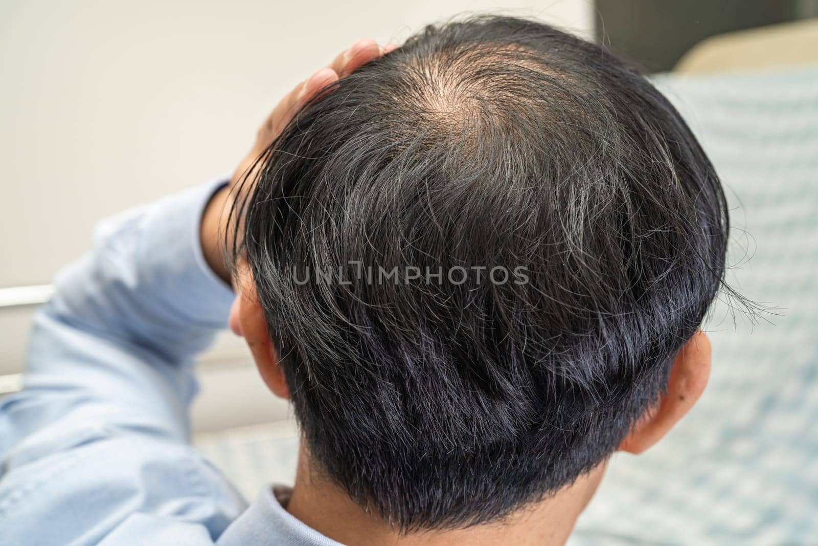 Bald in the middle head and begin no loss hair glabrous of mature Asian business smart active office man. by pamai