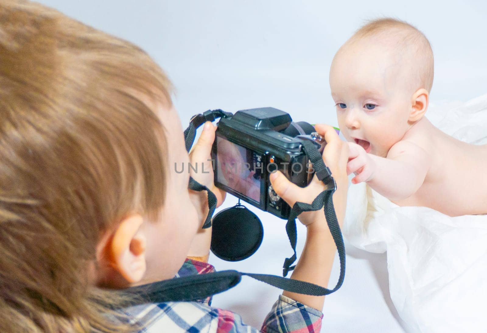 a baby with a hemangioma on his neck lies on a white background. baby photography. an older brother with a camera shoots a little sister