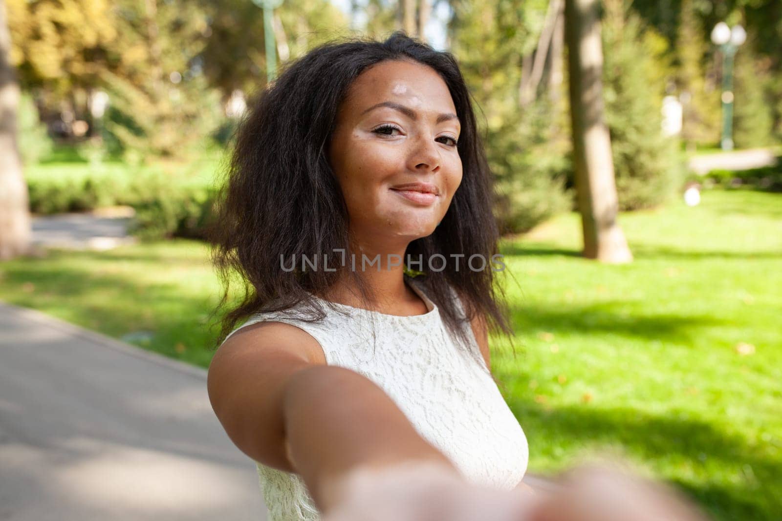Smiling woman with vitiligo pigmentation skin problem taking selfie in park. Portrait of African American lady spending leisure time outdoors during weekend