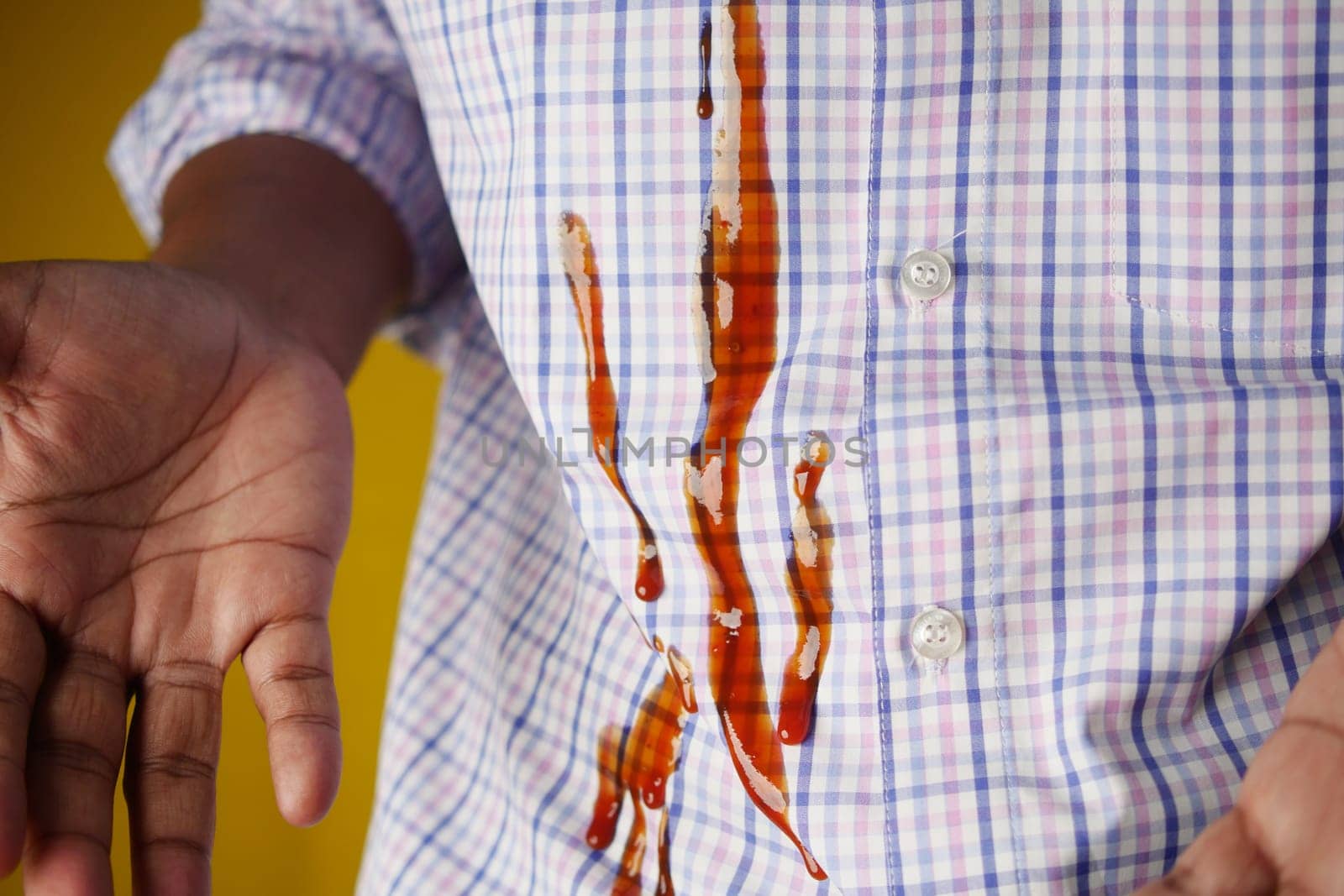 A spill of ketchup from a squeeze bottle on a yellow shirt resulted in a messy stain