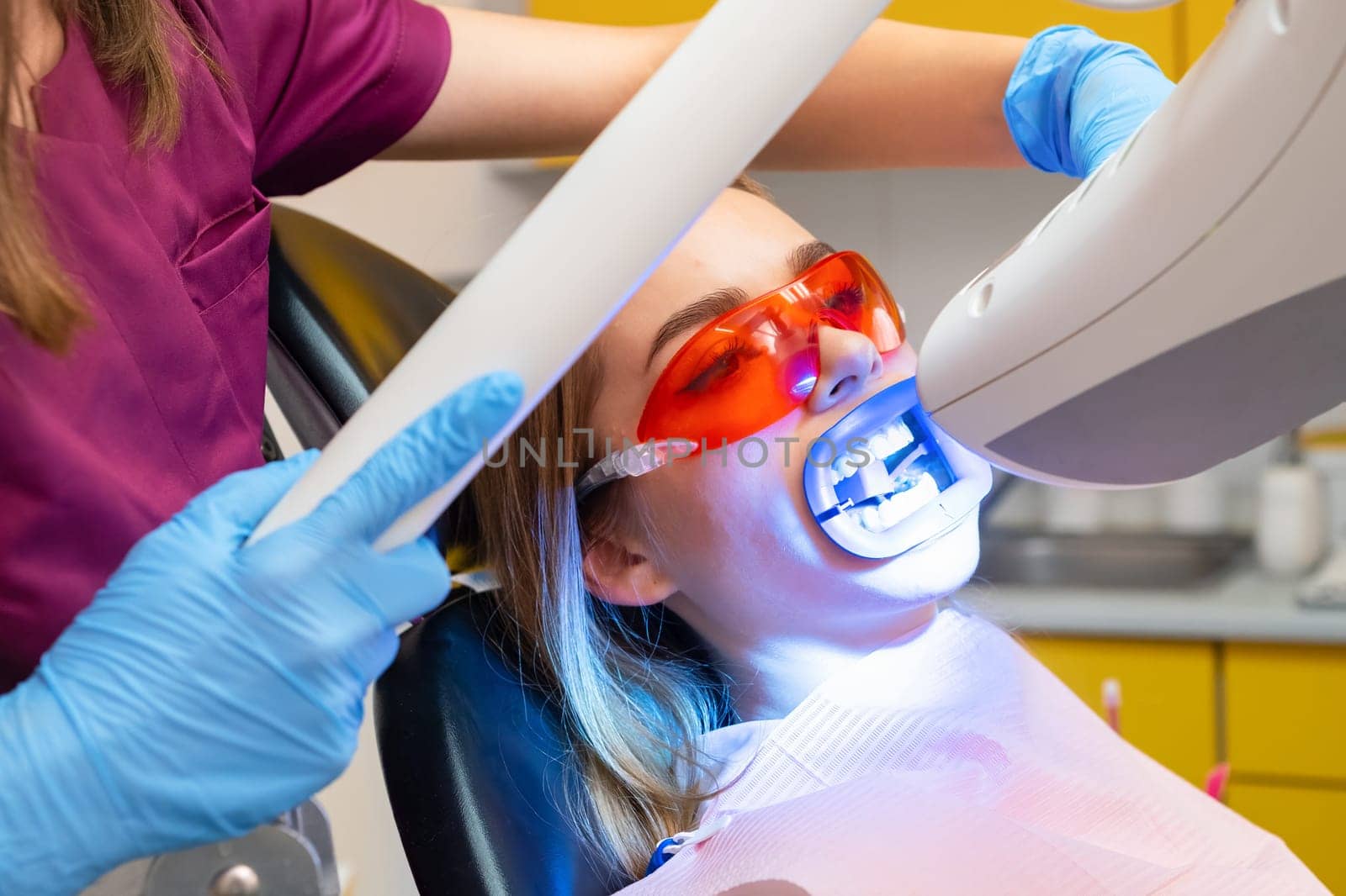 Teeth whitening, including the application of a UV lamp for bleaching, is performed for a woman at the dentists clinic.