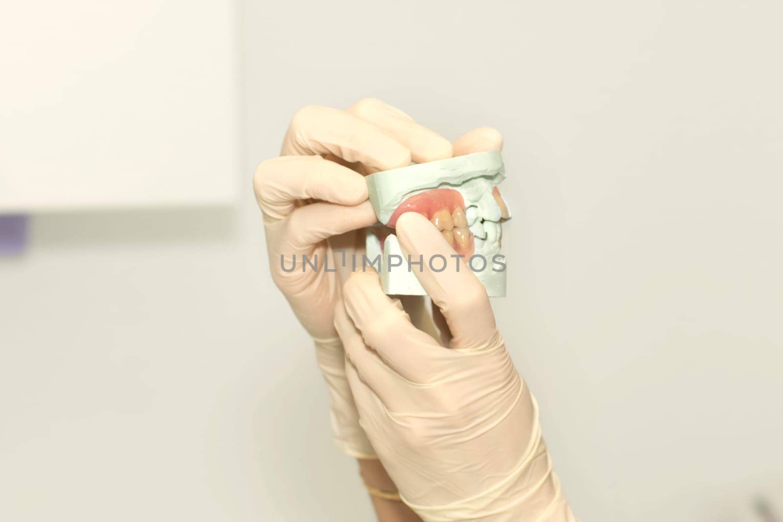 Dentist shows plaster cast of teeth wearing gloves