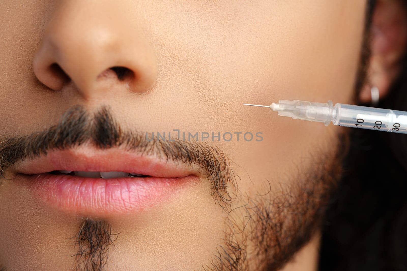 Man receiving facial treatment with a syringe for enhancing appearance, likely in a modern clinic
