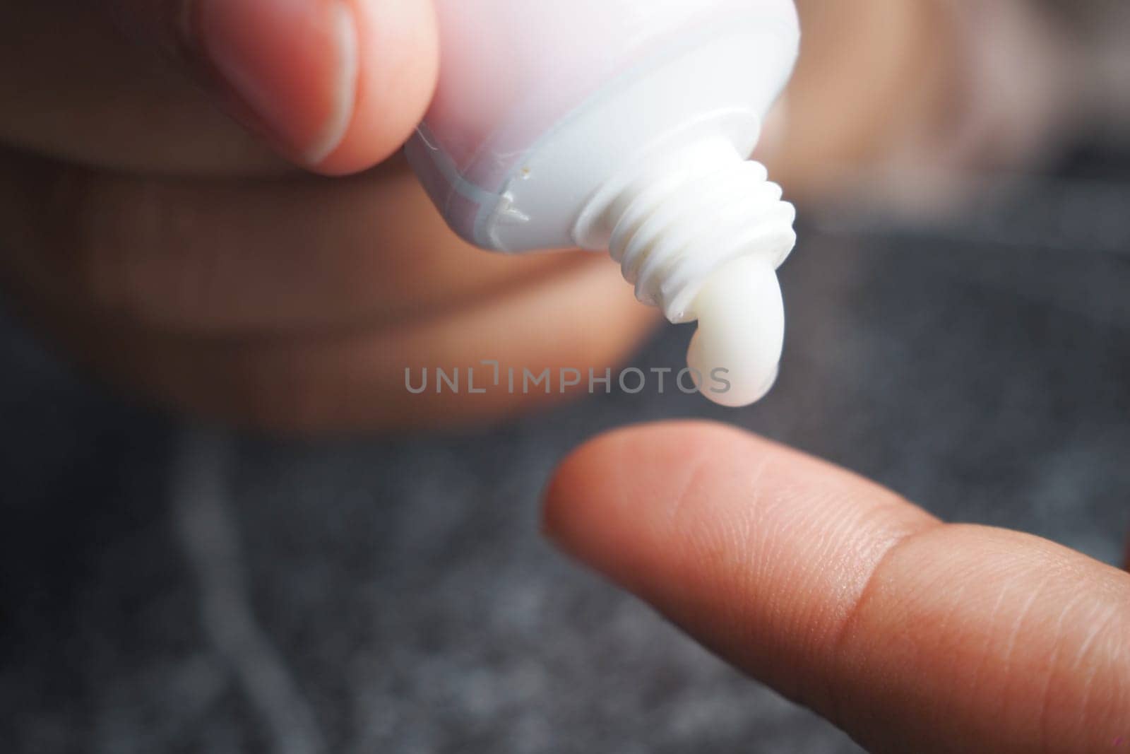 A finger dipped in cream from a tube, perfectly poised and ready for application on skin