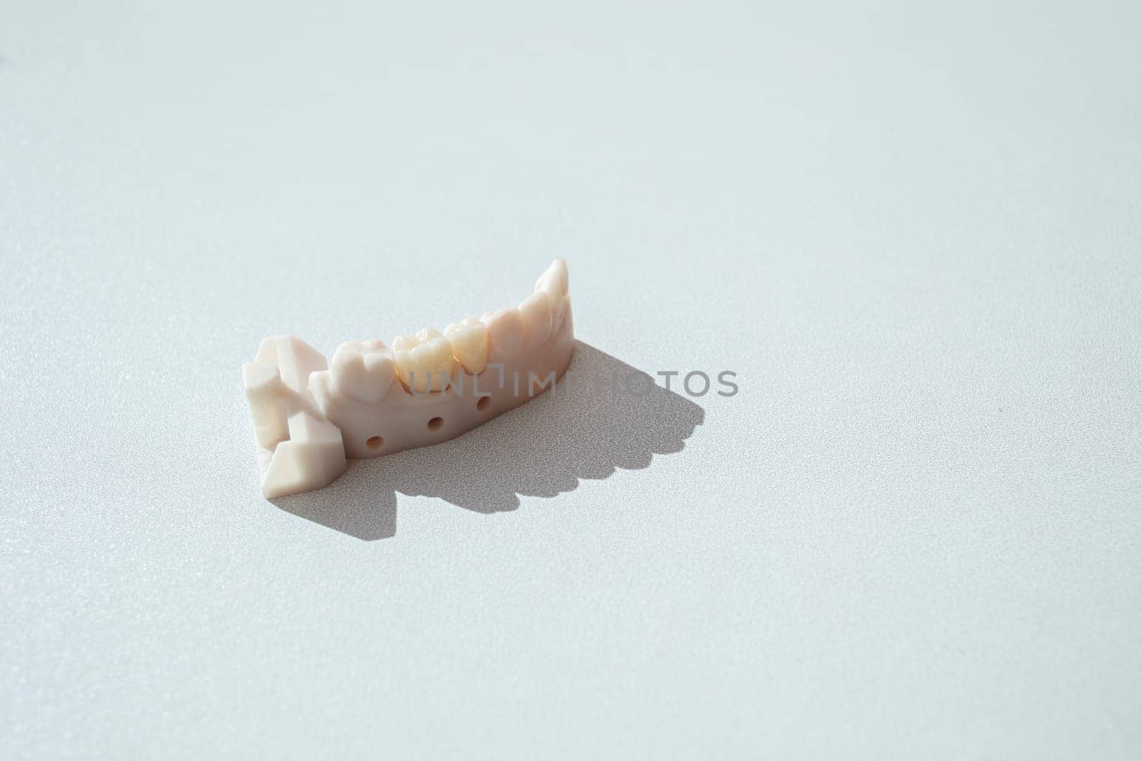 Top View Teeth Crowns, Bridge Dental Equipment Model For Tooth Restoration. Inserting Or Placing Procedure Of Ceramic Dental Crown. Horizontal View, Space For Text. High quality photo